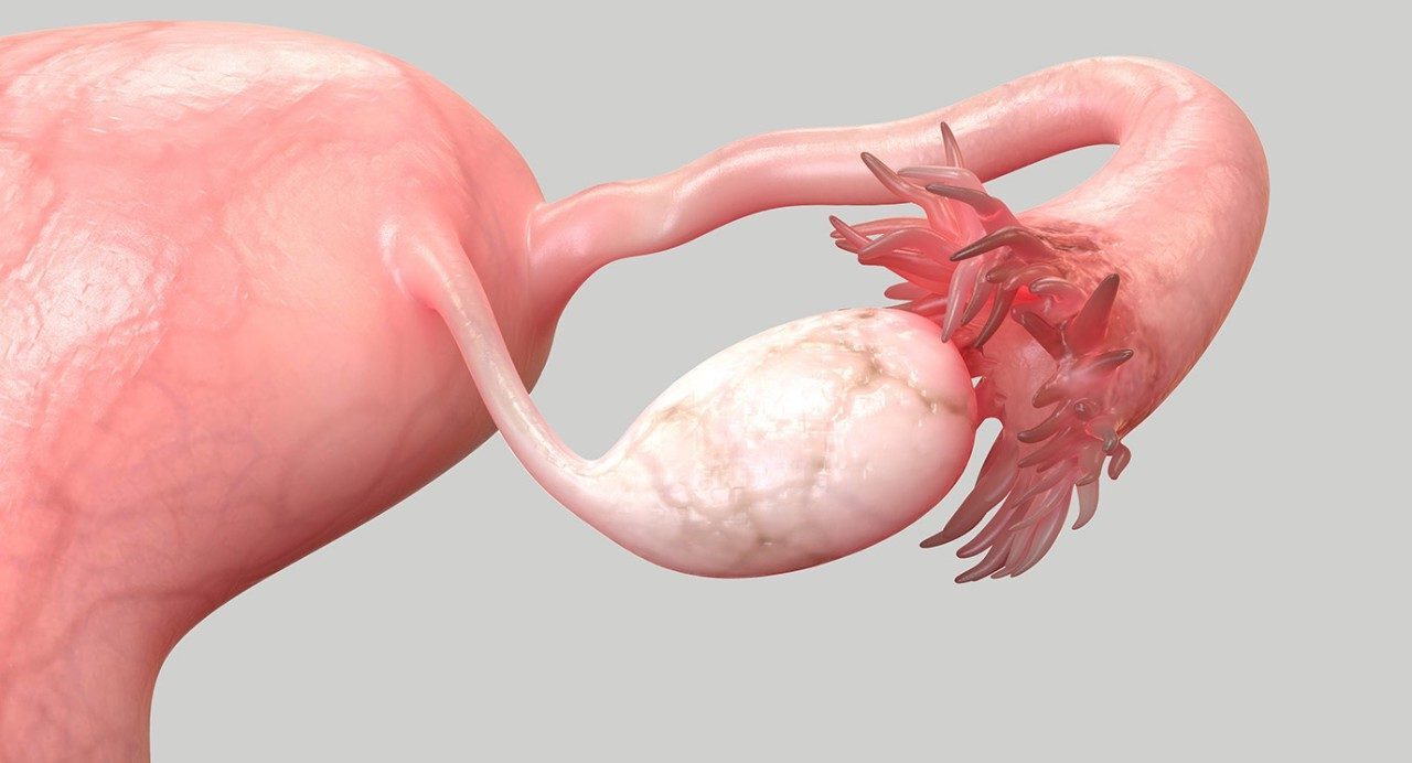 50-facts-about-fallopian-tube-cancer