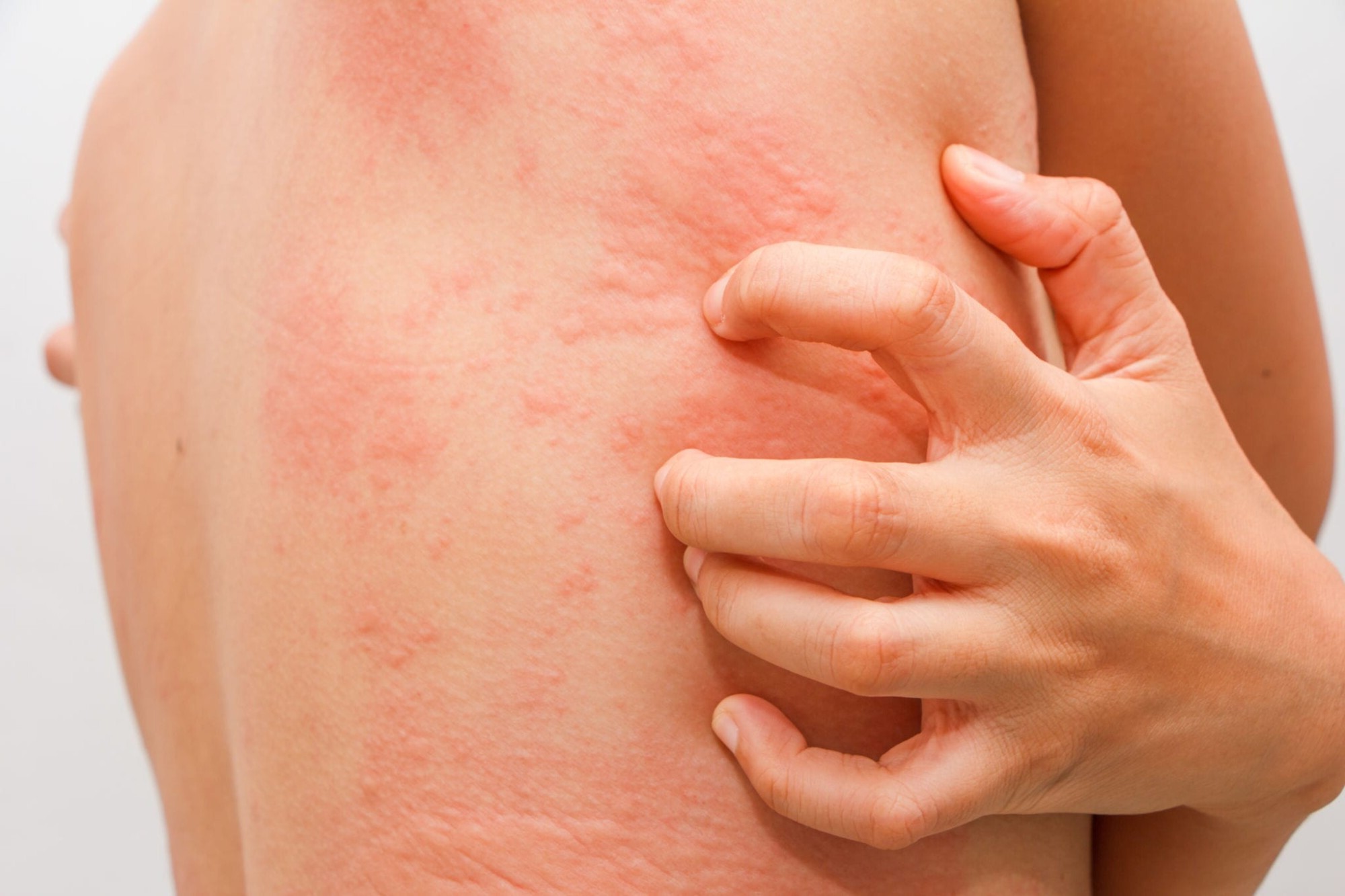 50-facts-about-histamine