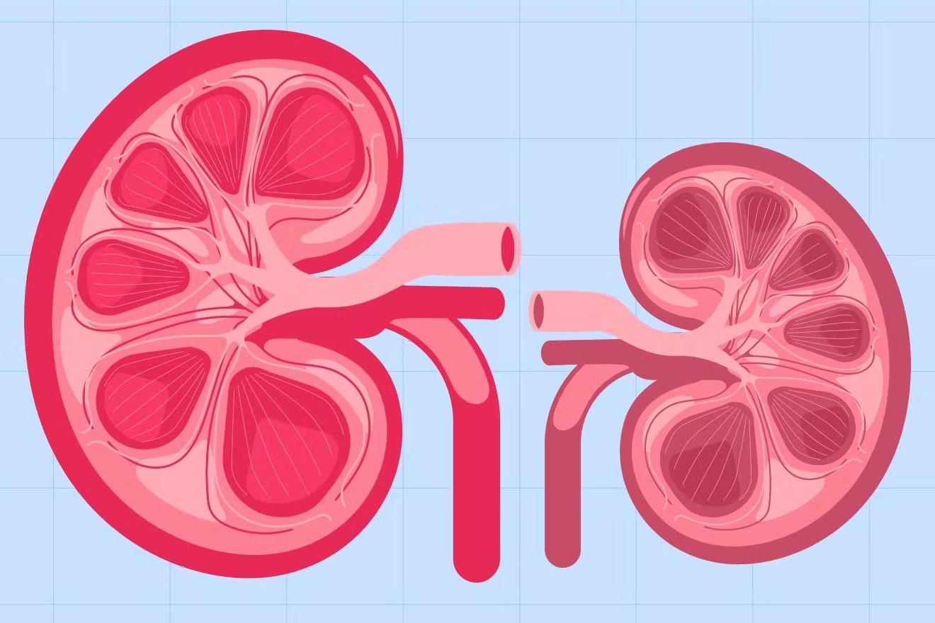 50-facts-about-hydronephrosis