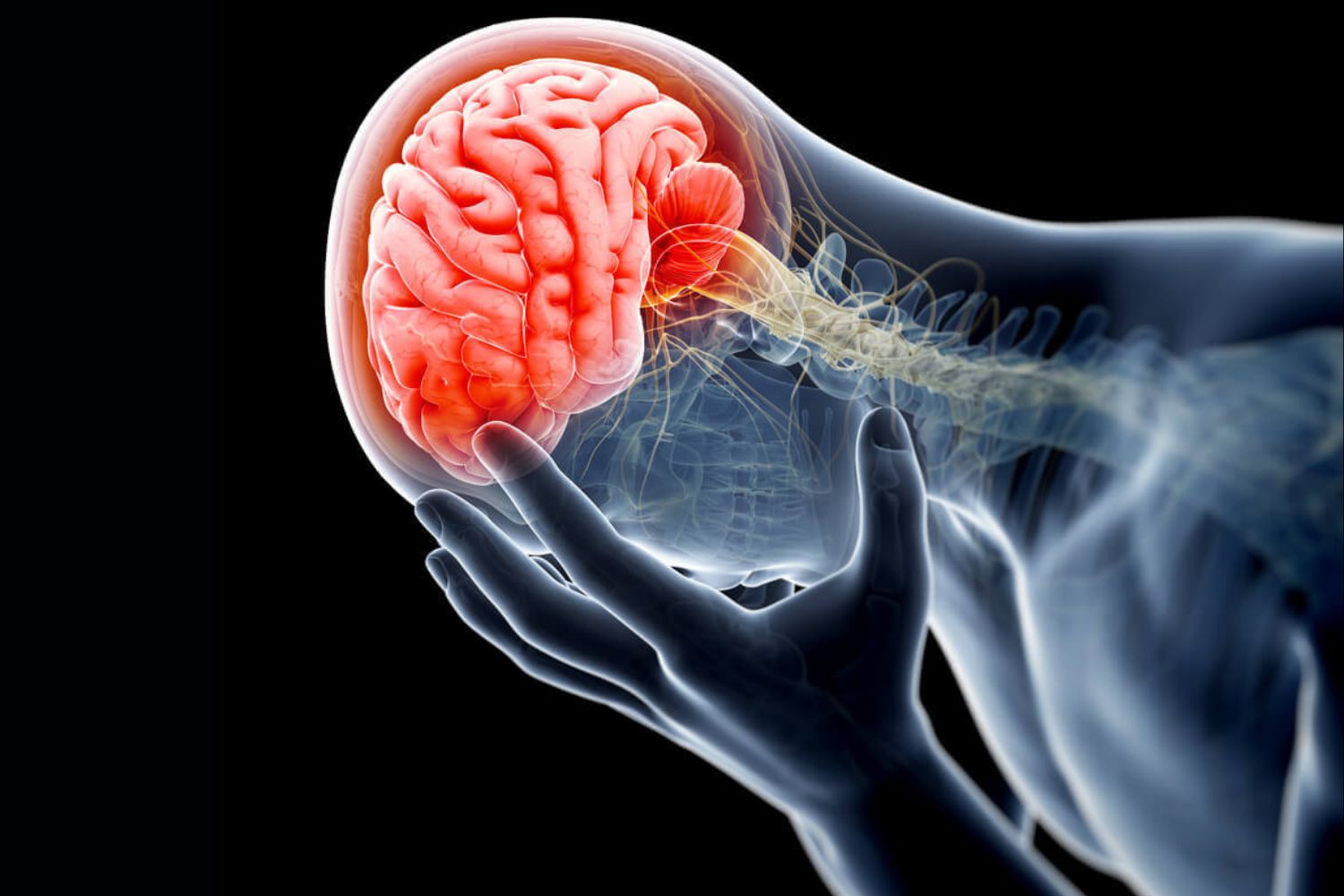 50-facts-about-intracerebral-hemorrhage