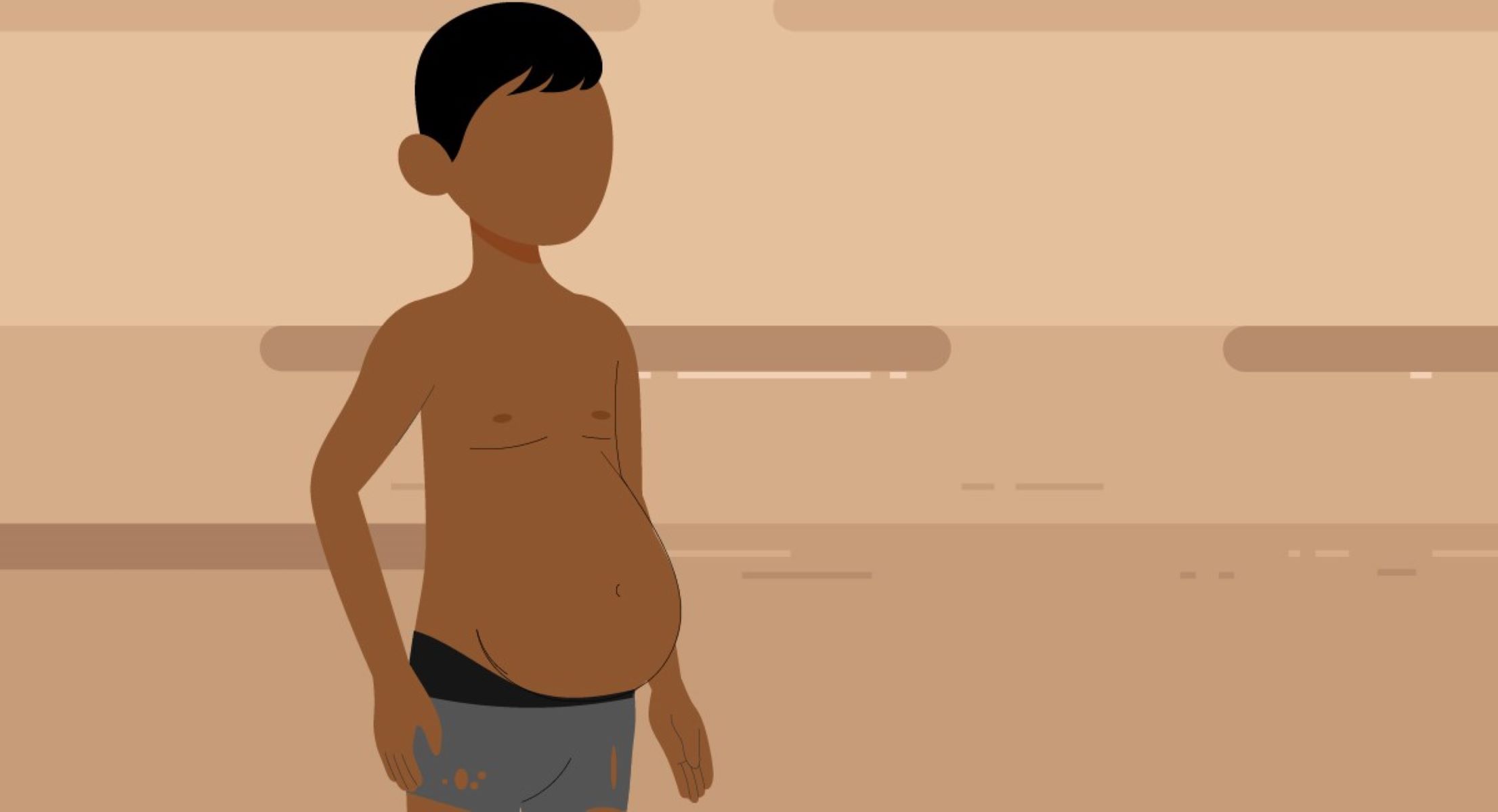 50-facts-about-kwashiorkor