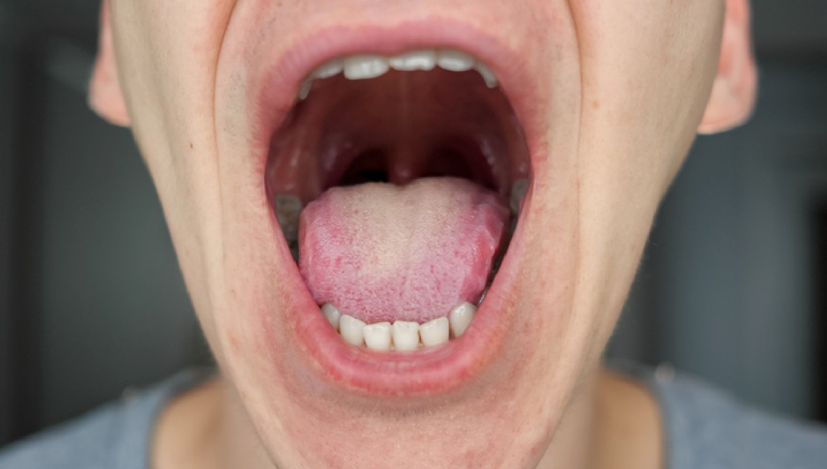 50-facts-about-mouth-cancer