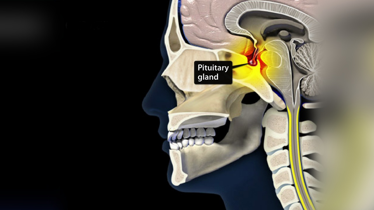 50-facts-about-pituitary-tumor