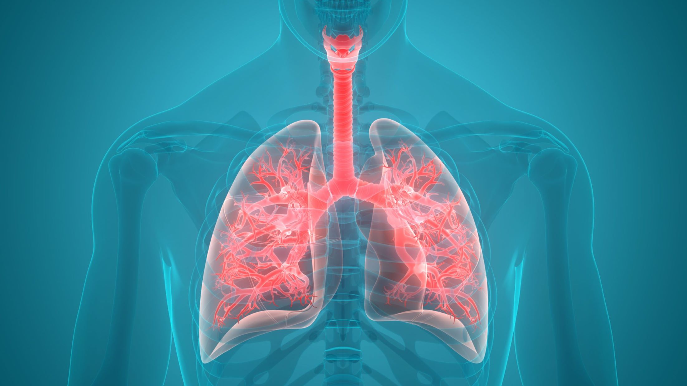 50-facts-about-pneumonia