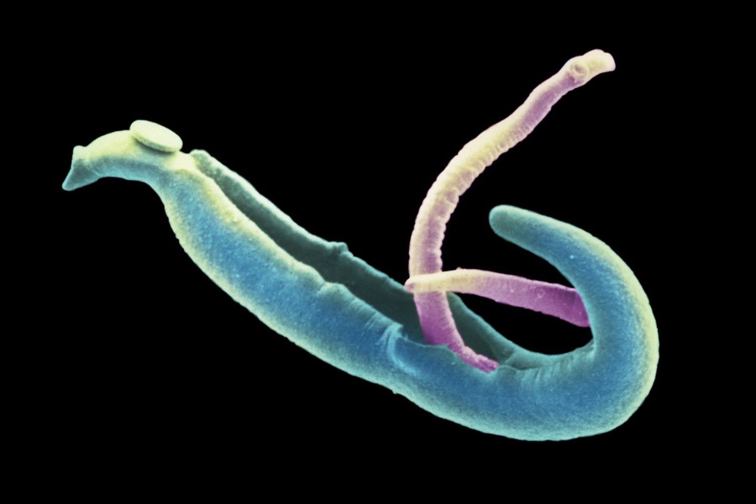 50-facts-about-schistosomiasis