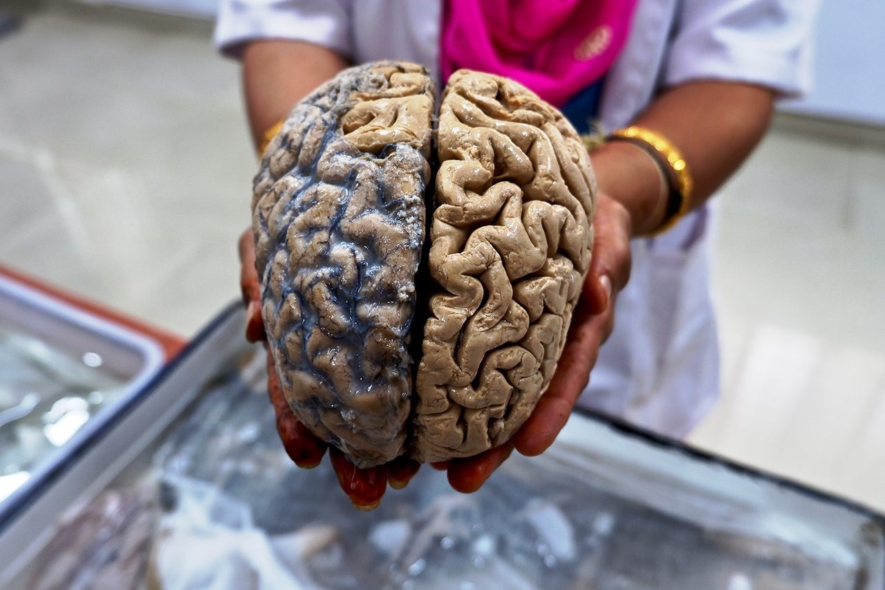 50-facts-about-the-human-brain-that-will-astonish-you