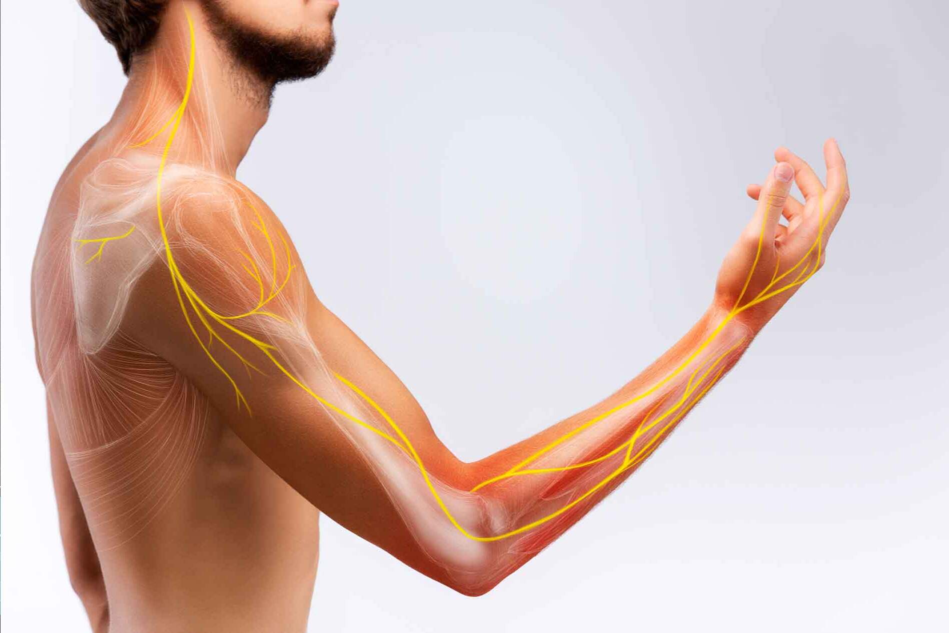 50-facts-about-thoracic-outlet-syndrome