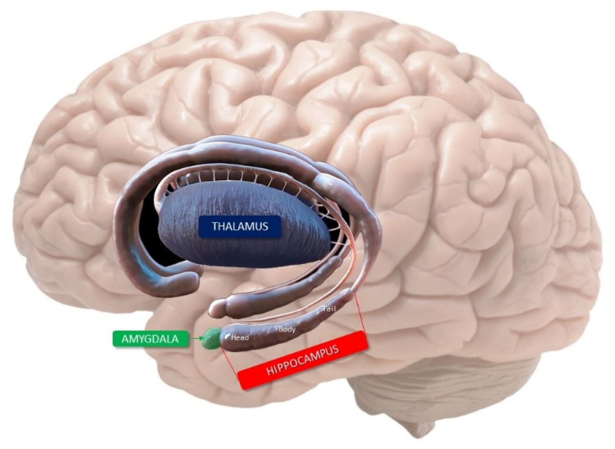 50-facts-about-transient-global-amnesia