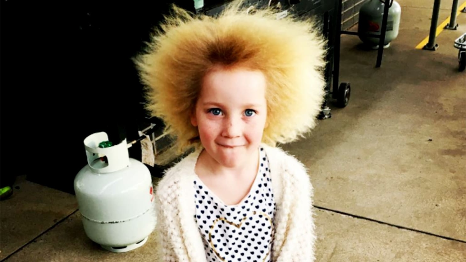 50-facts-about-uncombable-hair-syndrome