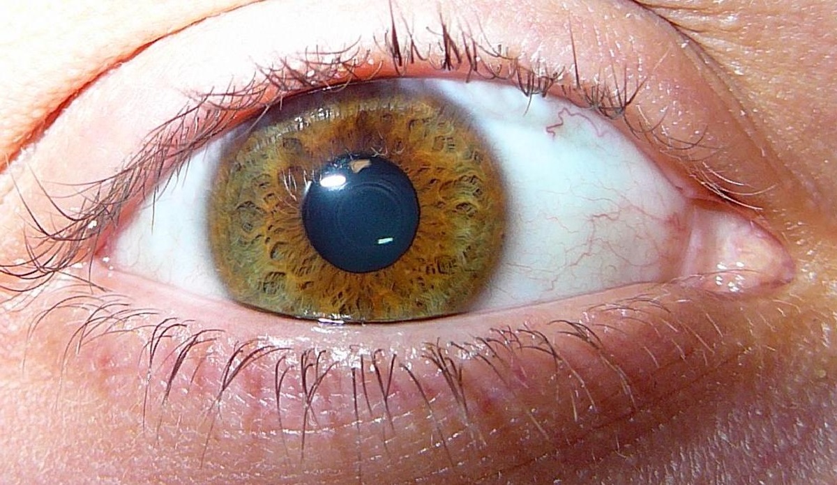 50-facts-about-uveal-melanoma