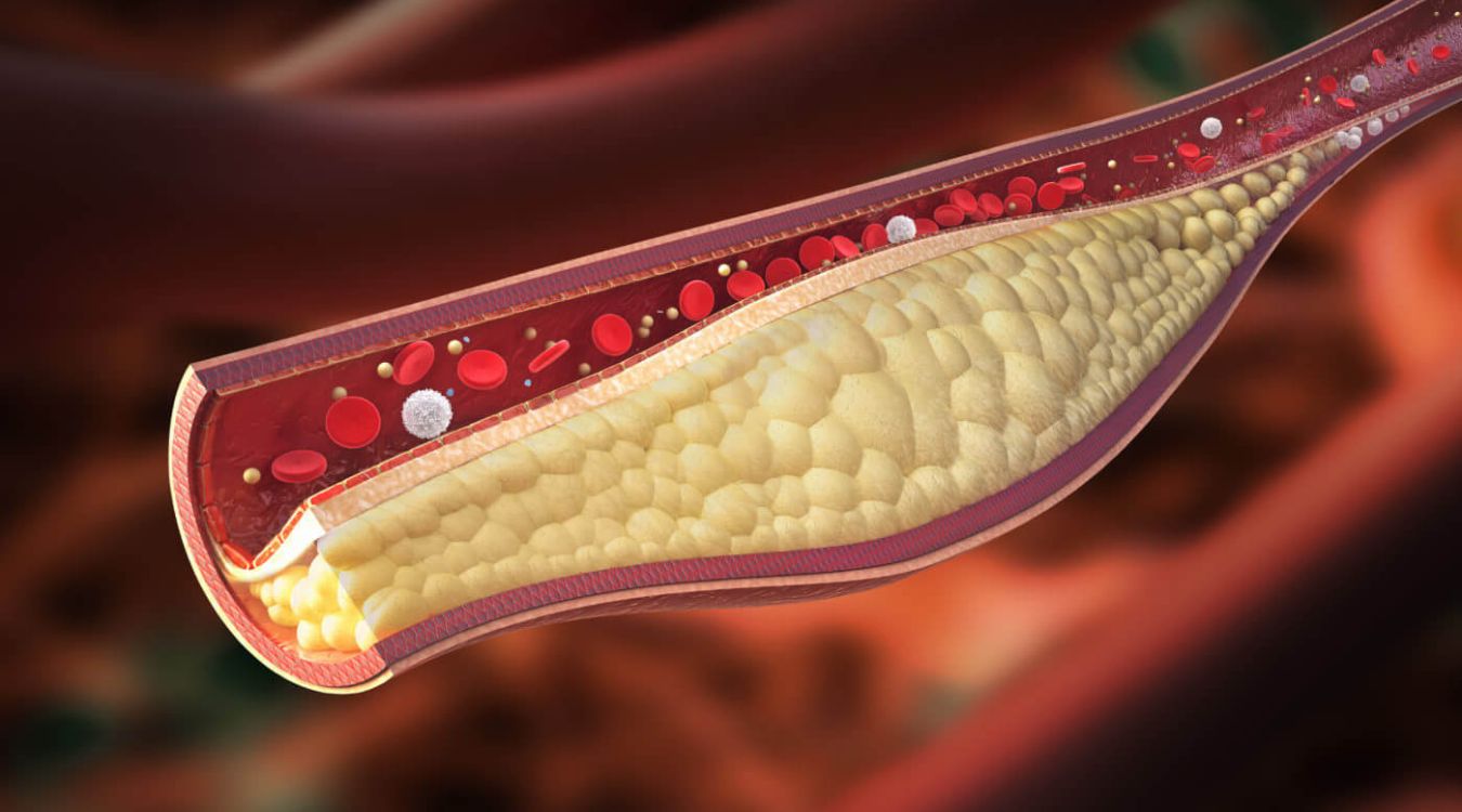 25-facts-about-atheronals