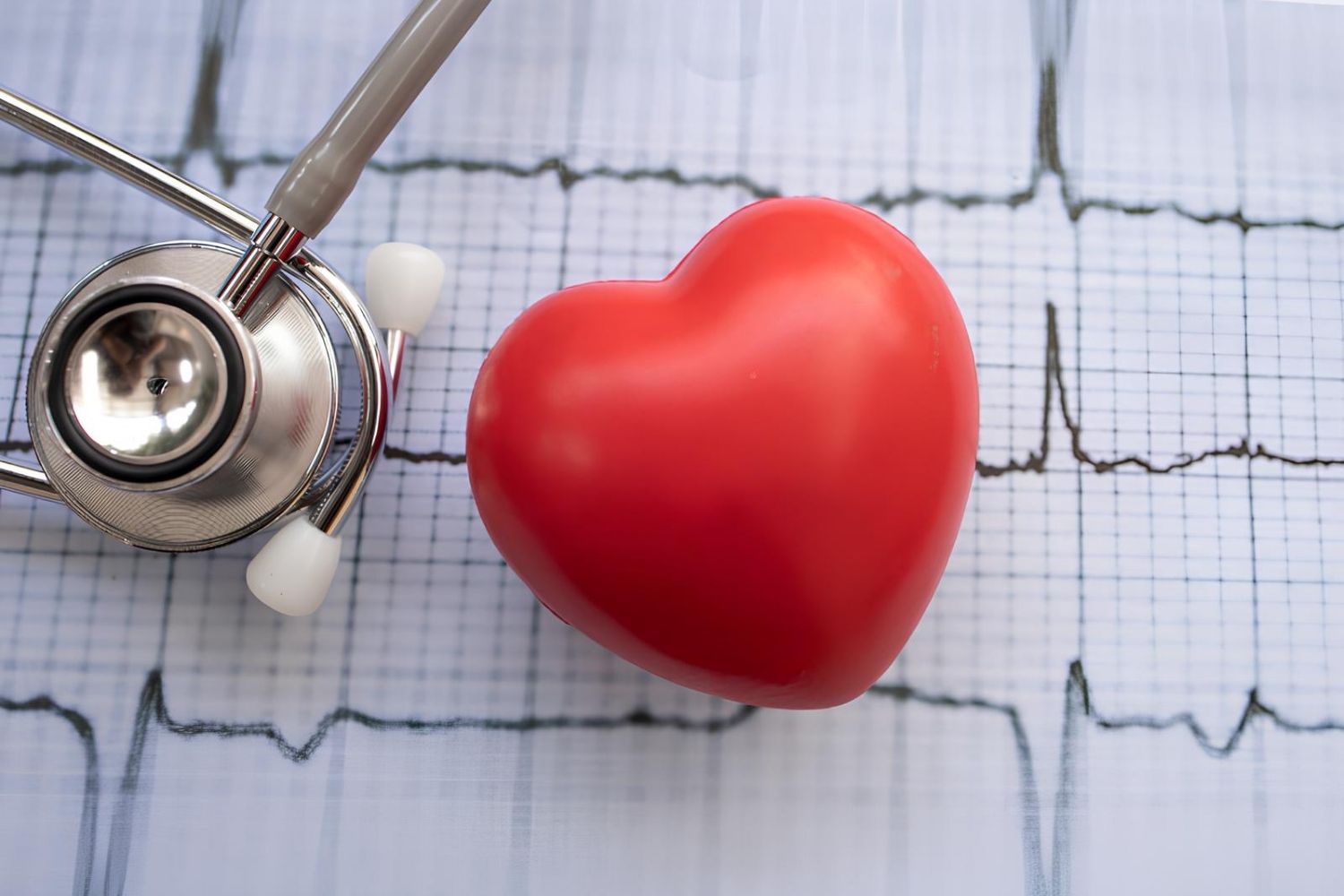 25-facts-about-double-tachycardia-induced-by-catecholamines