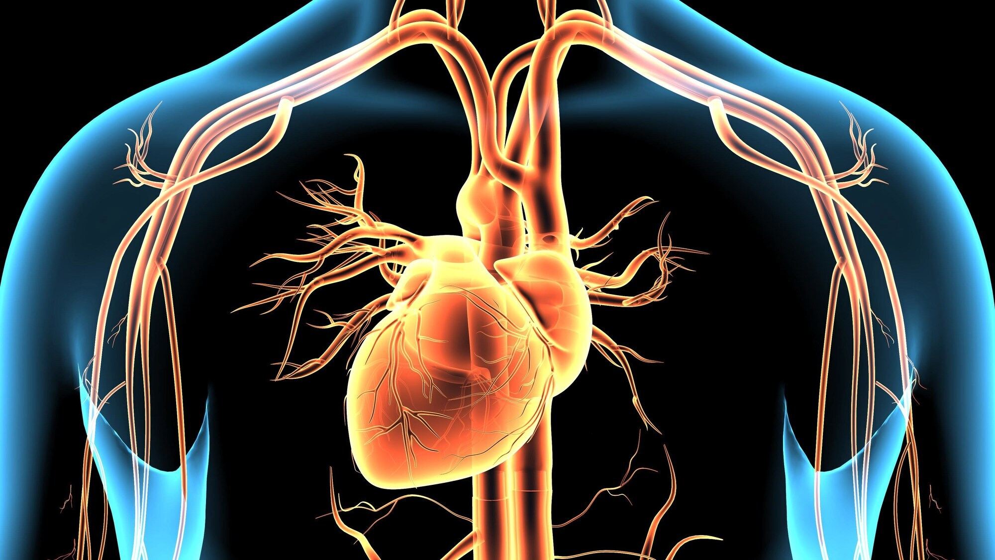 25-facts-about-holoprosencephaly-radial-heart-renal-anomalies