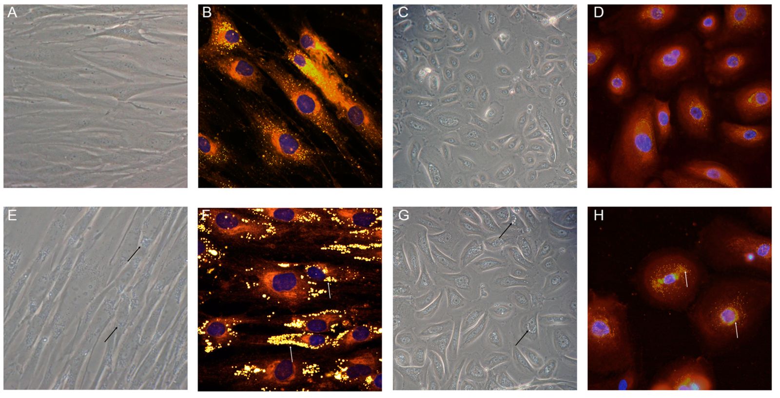 25-facts-about-lipidosis-with-triglyceride-storage-disease