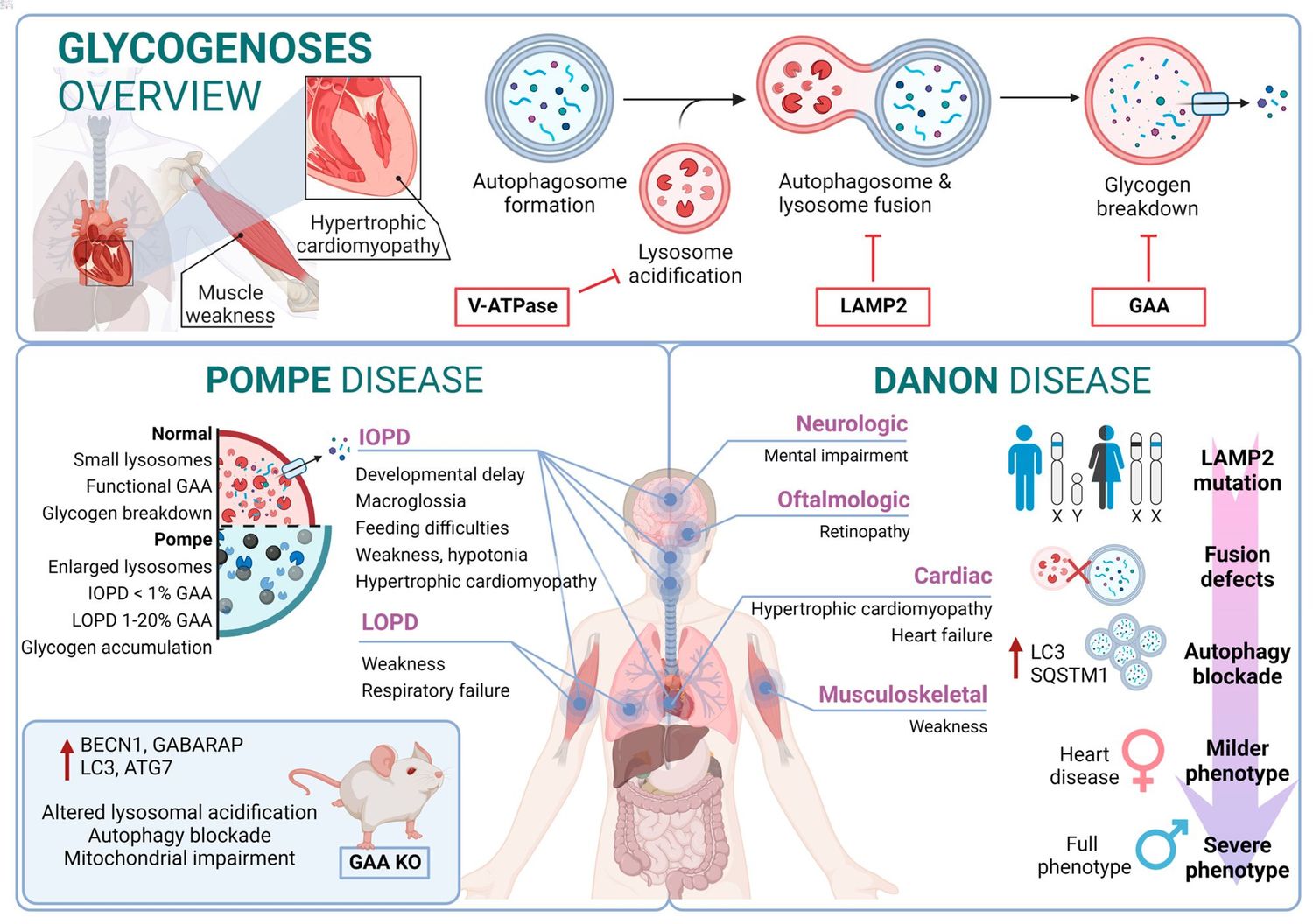 25-facts-about-lysosomal-beta-mannosidase-deficiency