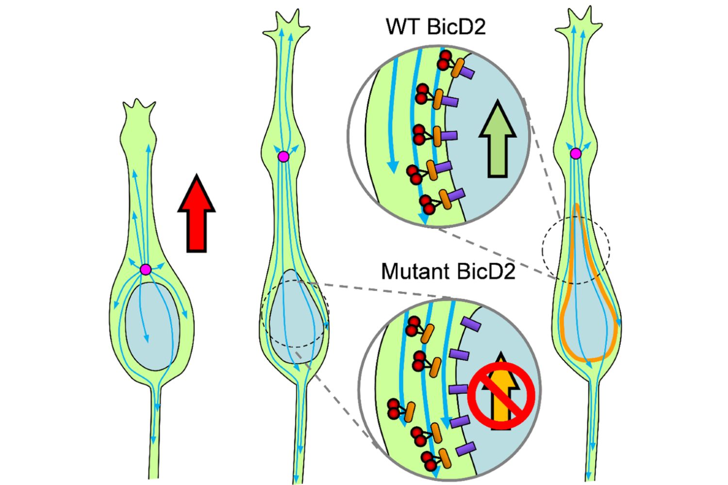 25-facts-about-malformations-in-neuronal-migration