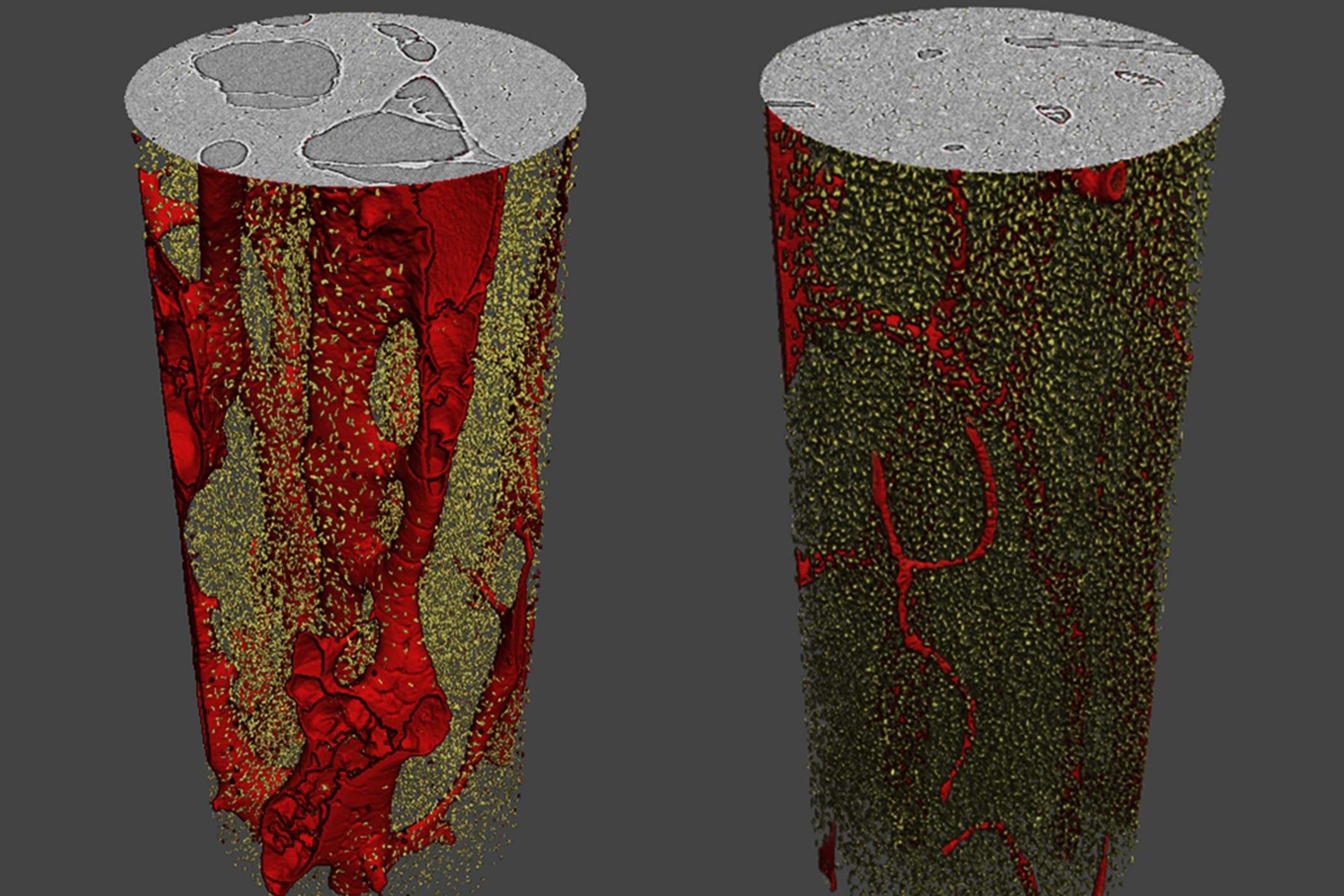 25-facts-about-microdamage-in-bone