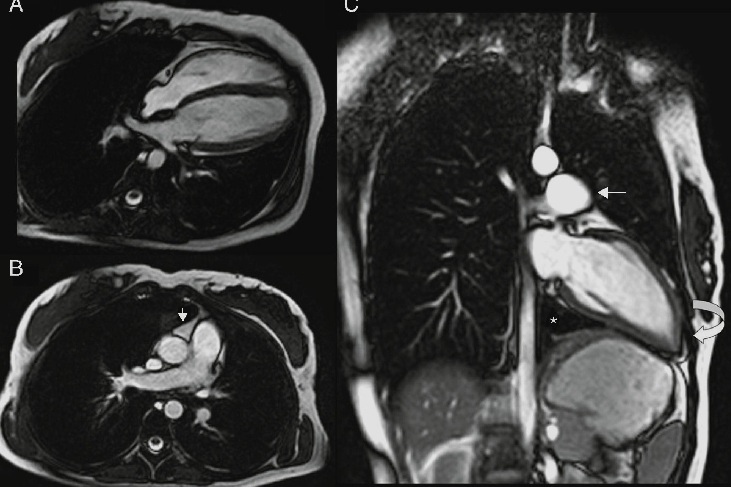 25-facts-about-pericardium-congenital-anomaly