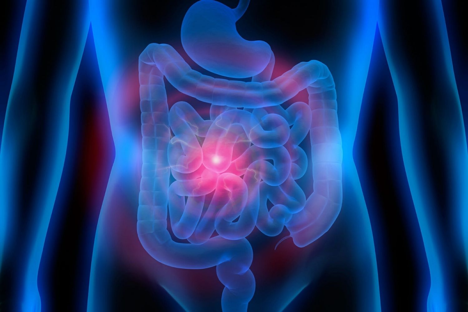 30-facts-about-gastrointestinal-autonomic-nerve-tumor