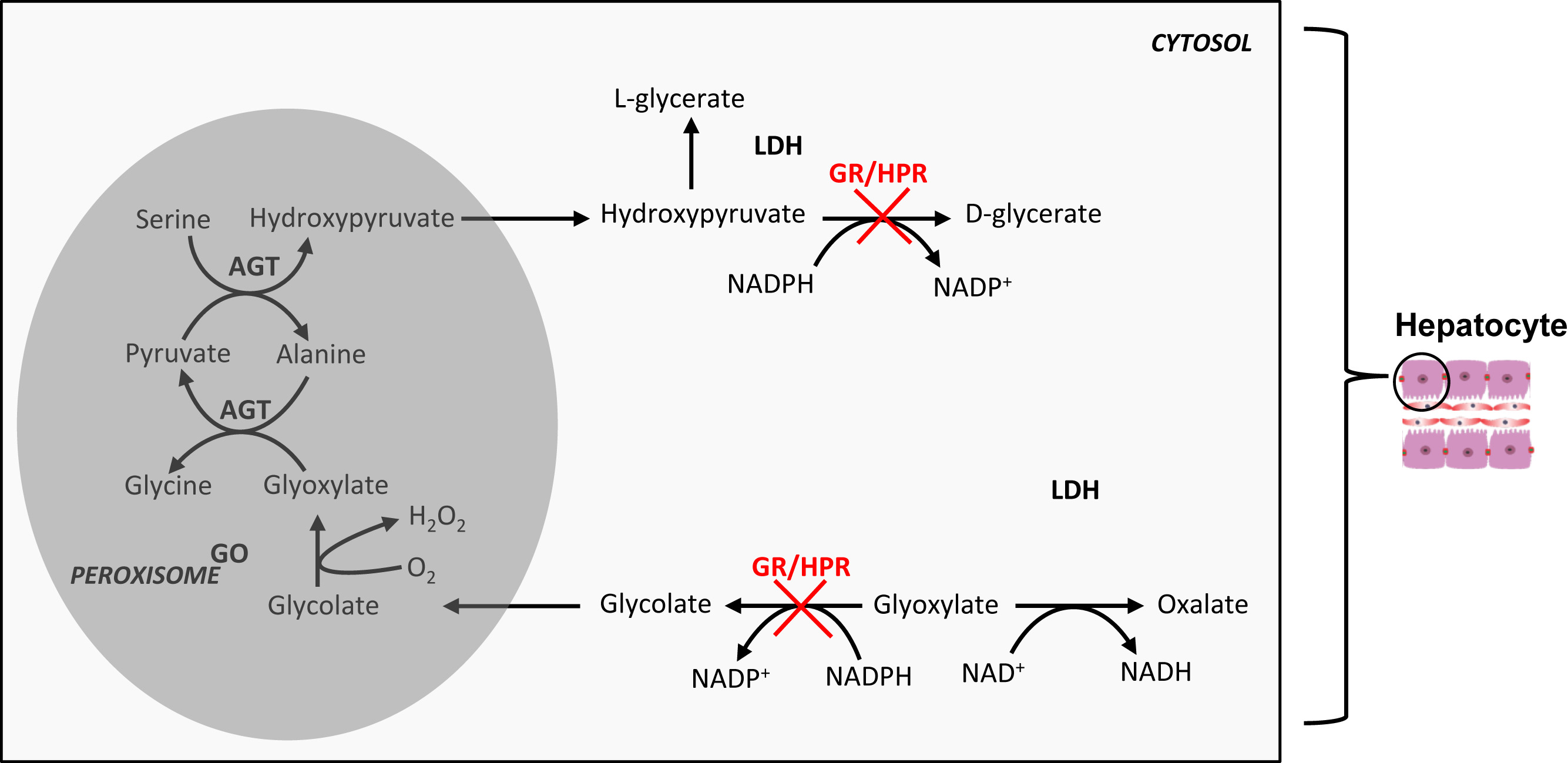 30-facts-about-hyperoxaluria-type-2