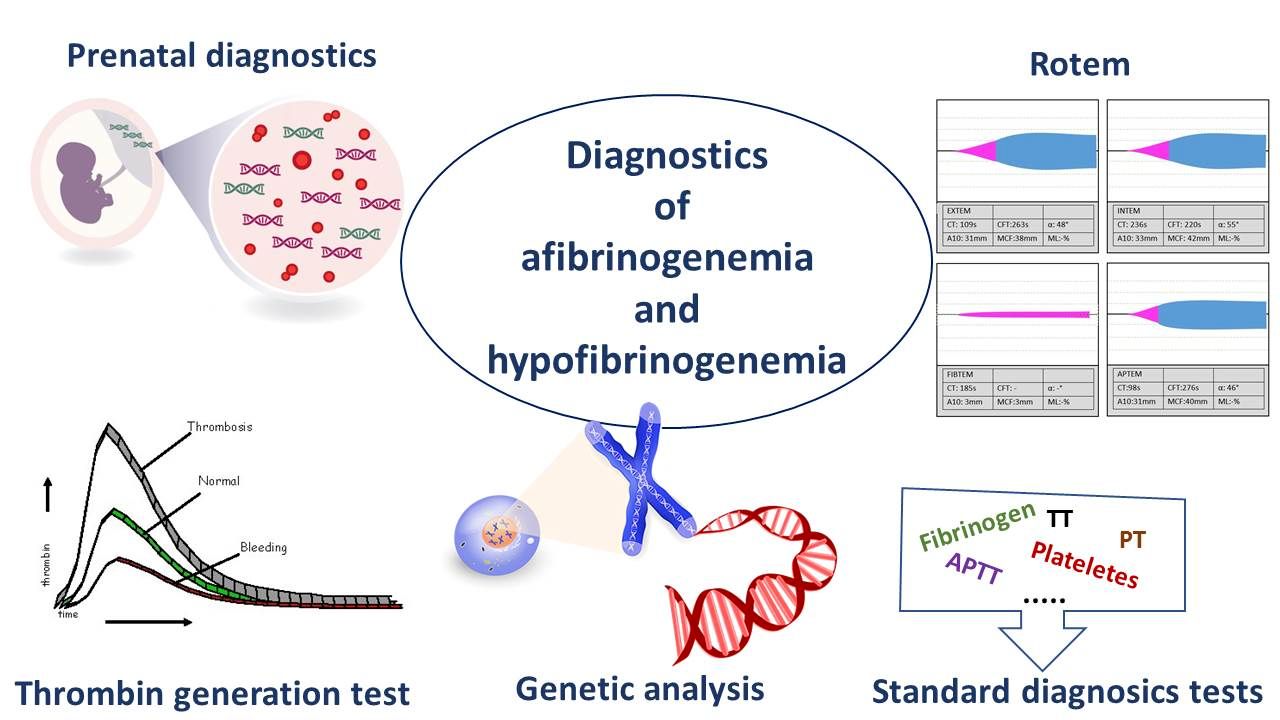 30-facts-about-hypodysfibrinogenemia