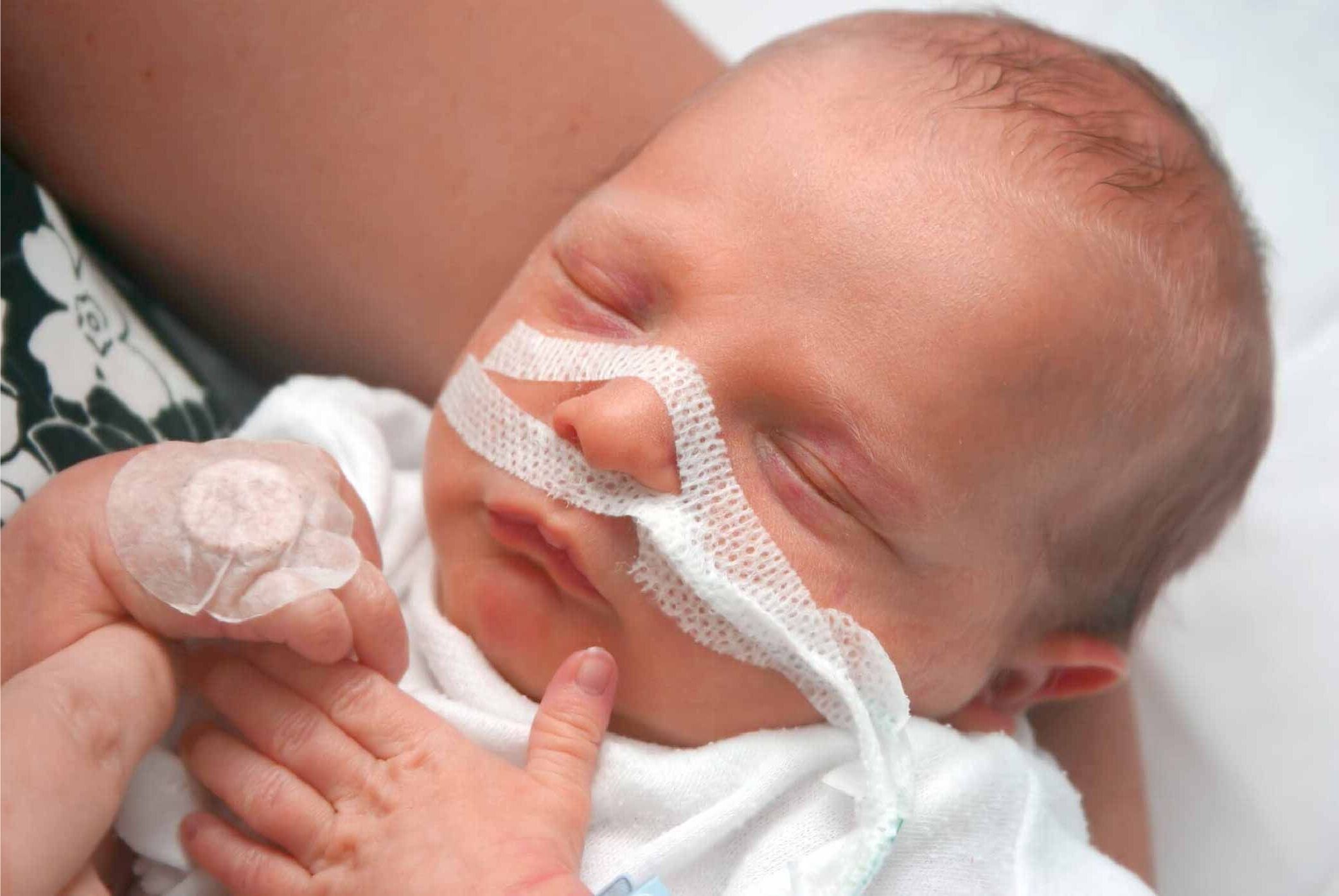 30-facts-about-infant-respiratory-distress