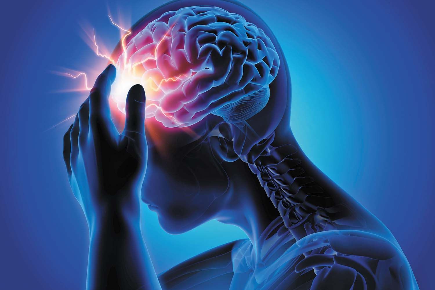 30-facts-about-nih-classification-of-headaches