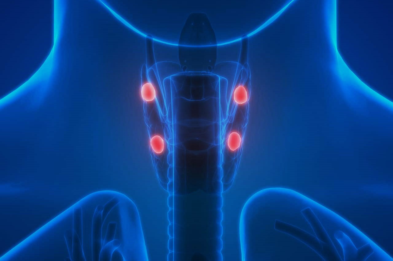 30-facts-about-parathyroid-neoplasm