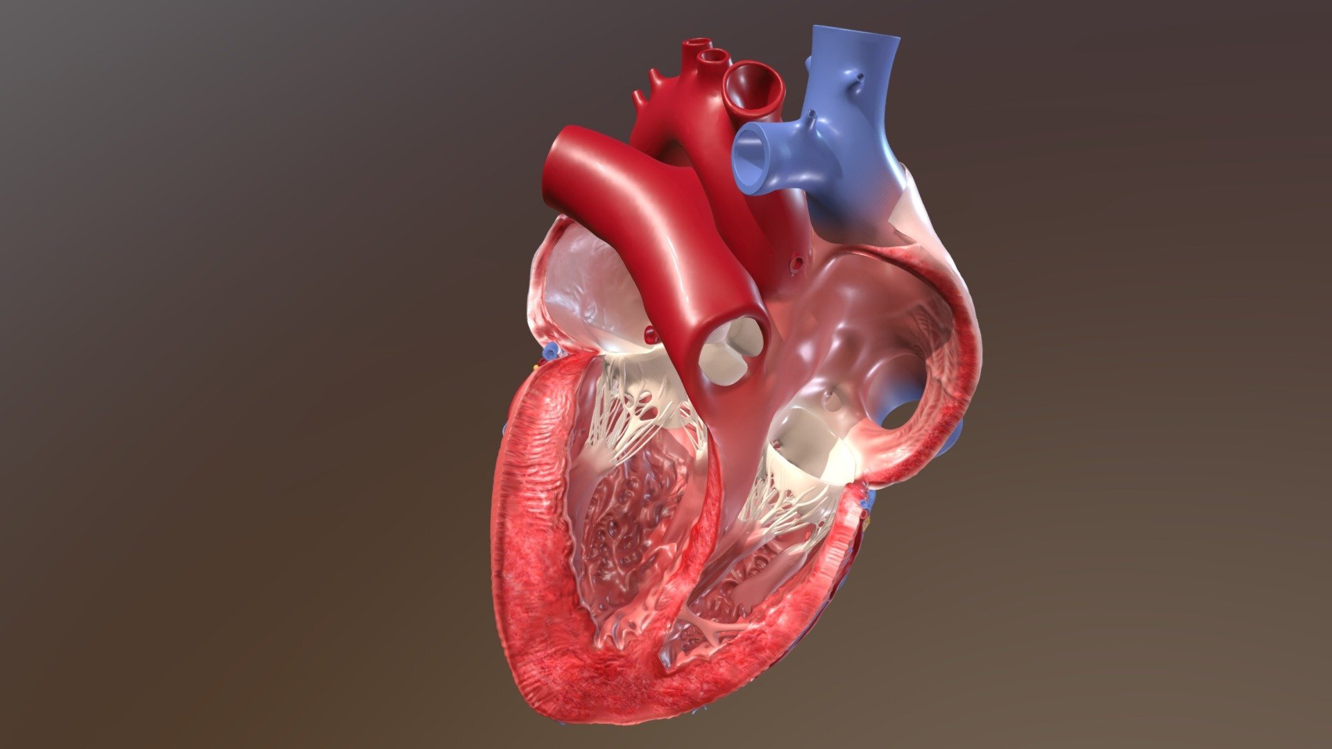 30-facts-about-partial-atrioventricular-canal