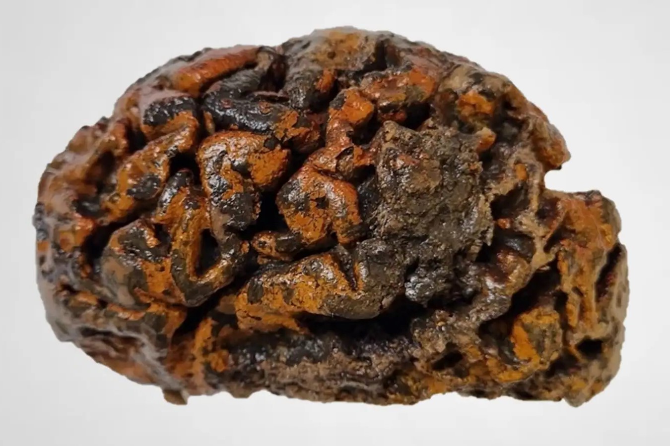 35-facts-about-4000-year-brain-preserved