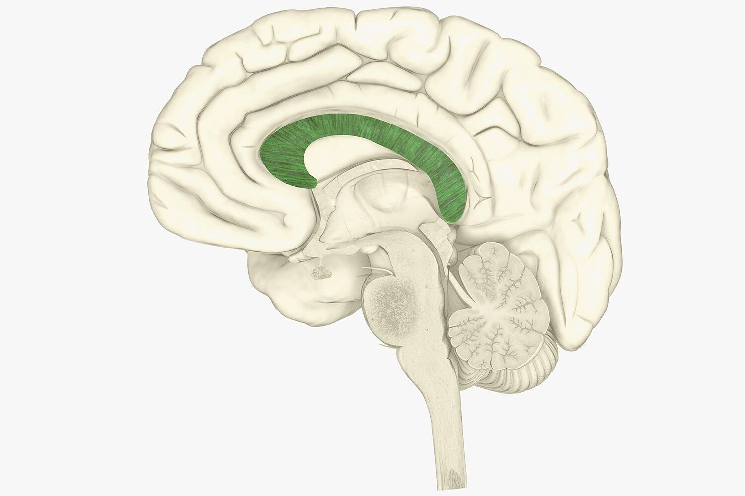 40-facts-about-partial-agenesis-of-corpus-callosum