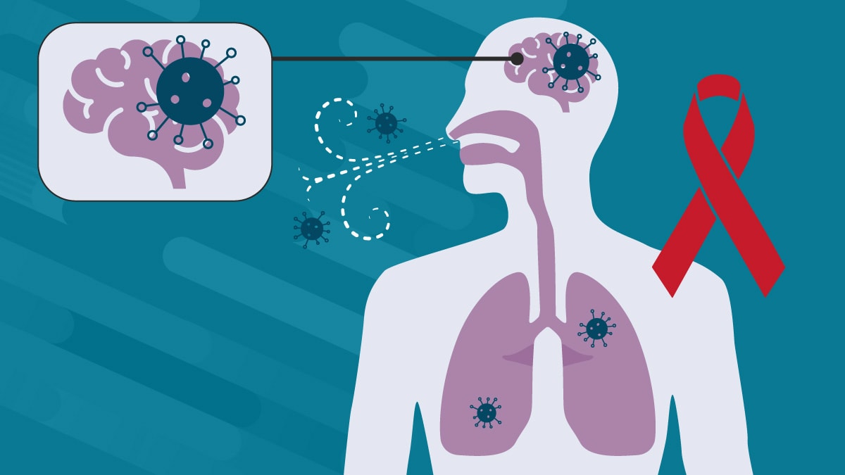 50-facts-about-cryptococcosis