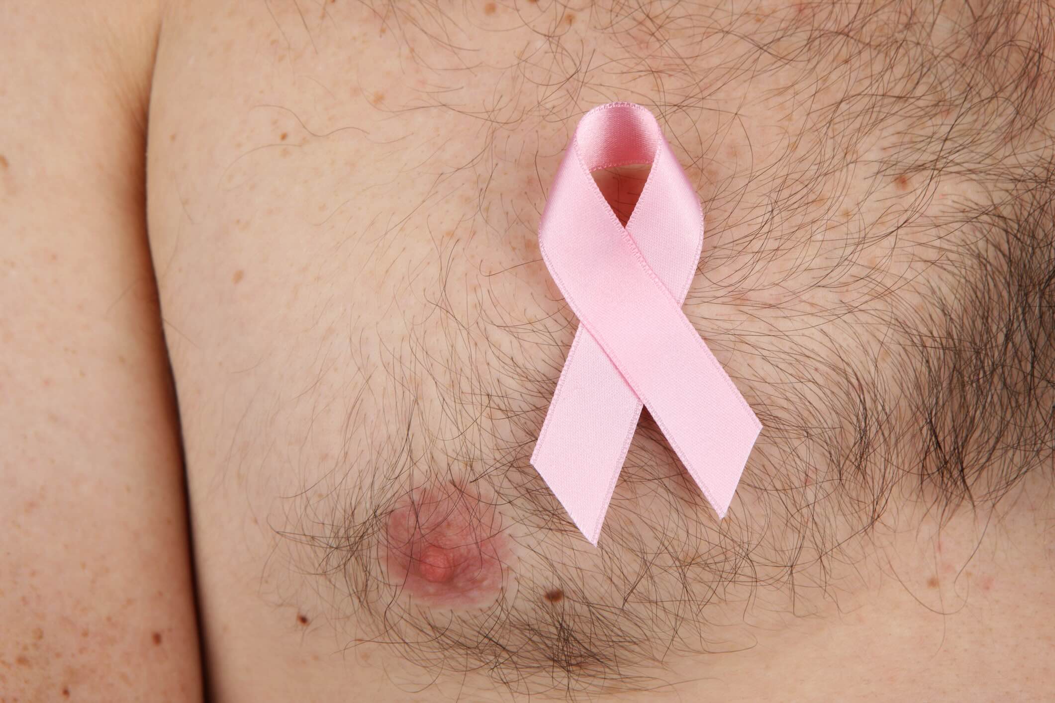 50-facts-about-male-breast-cancer