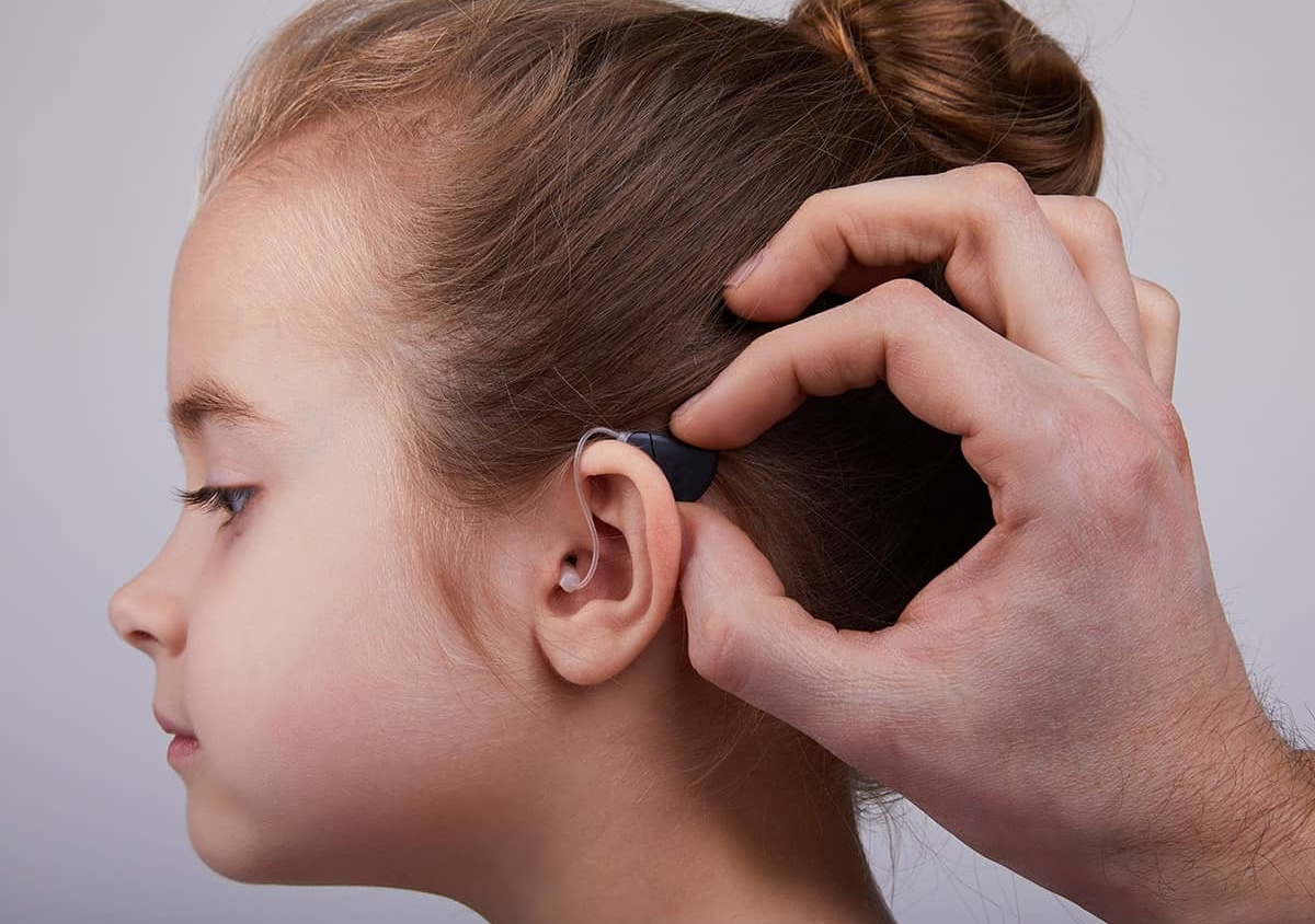 50-facts-about-microtia