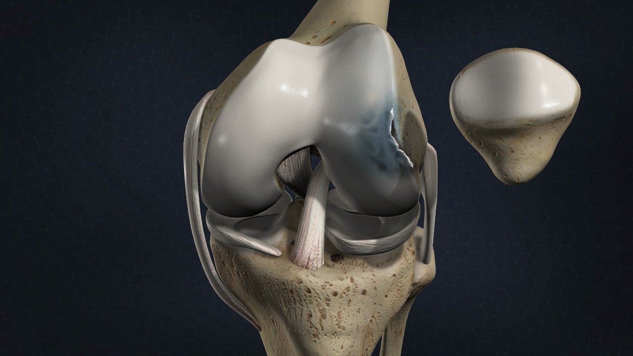 50-facts-about-osteochondritis