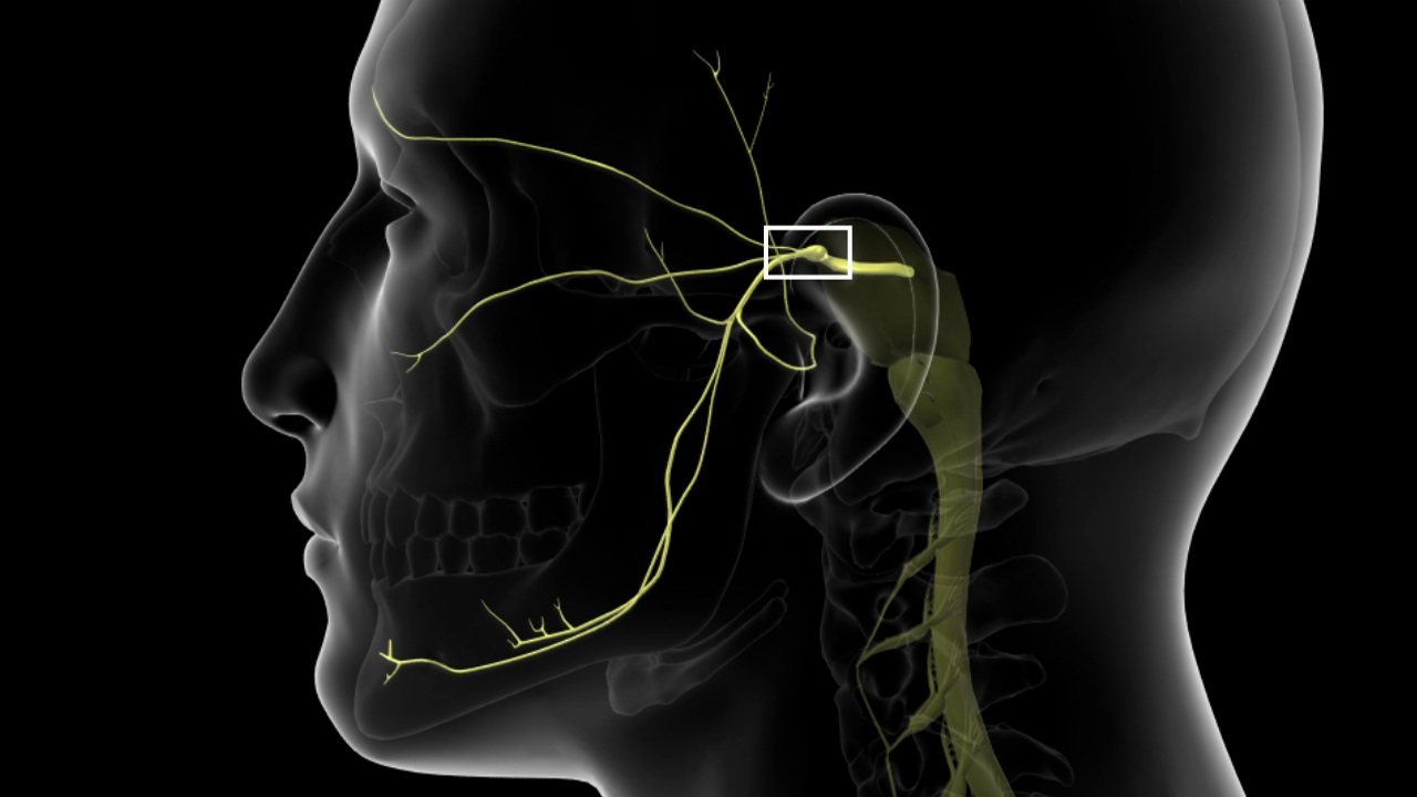 50-facts-about-trigeminal-neuralgia