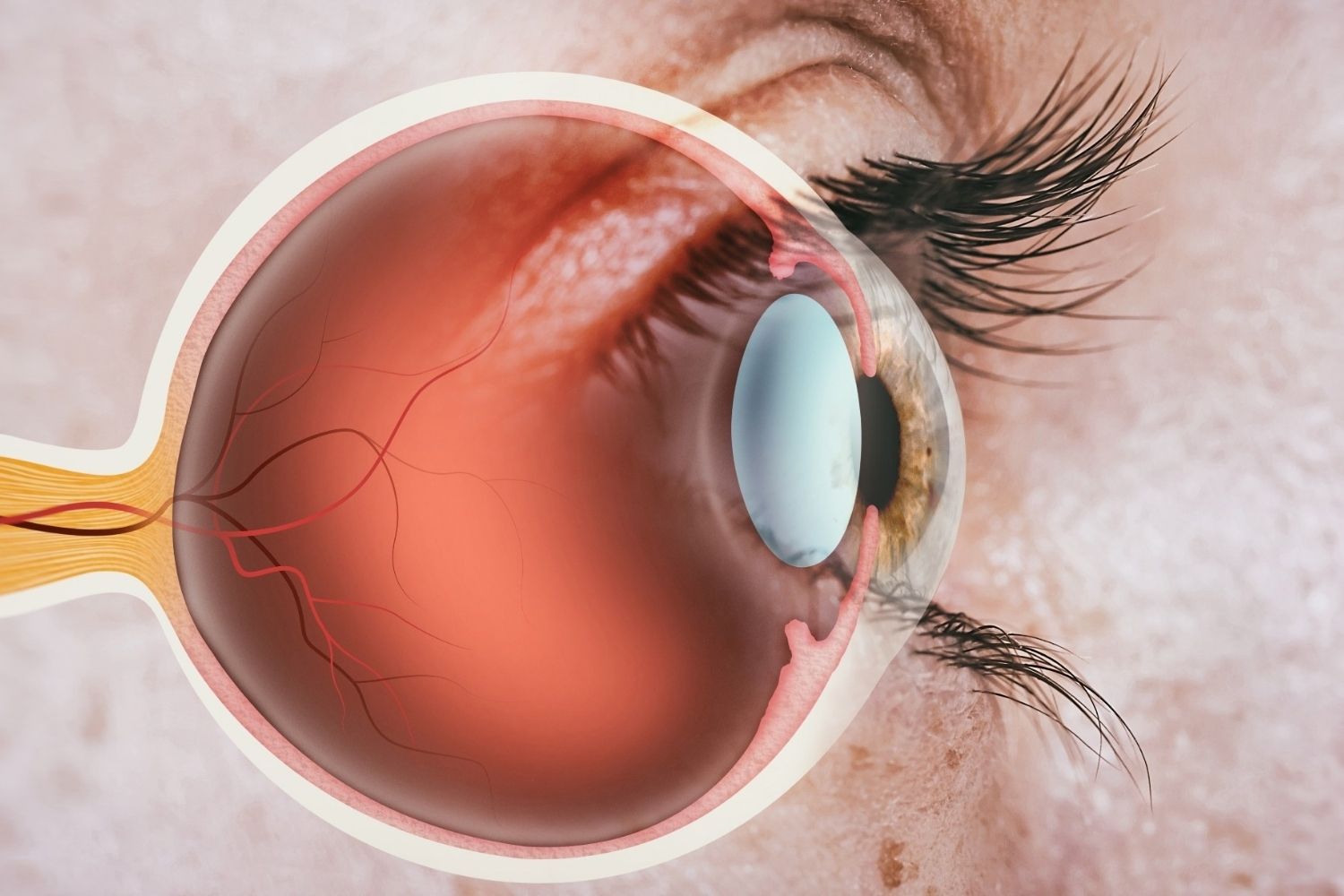 25-facts-about-familial-bilateral-optic-nerve-hypoplasia