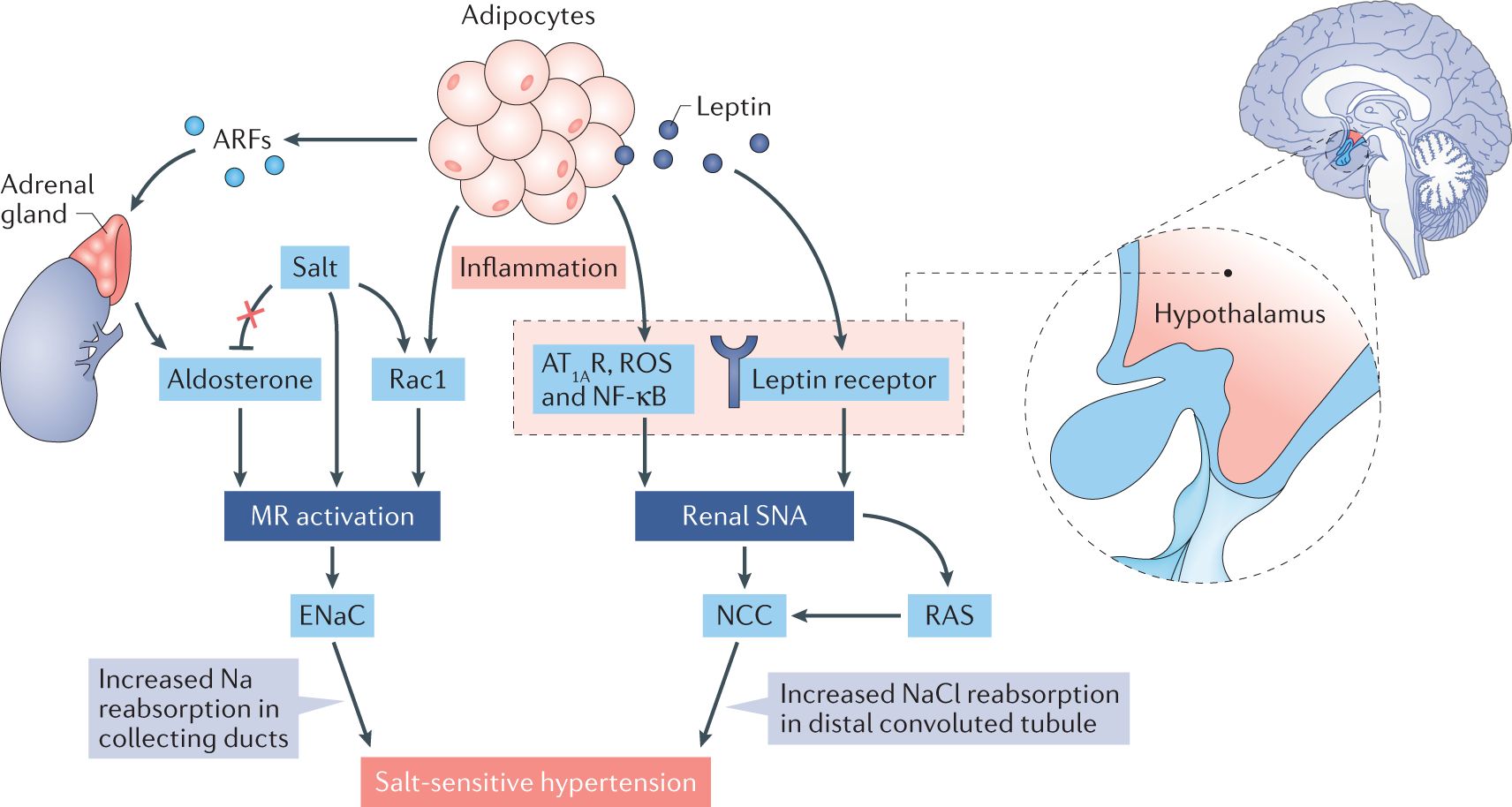 25-facts-about-glucocorticoid-sensitive-hypertension