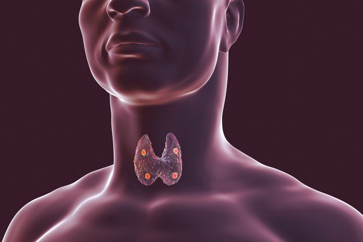 25-facts-about-nephropathy-deafness-hyperparathyroidism