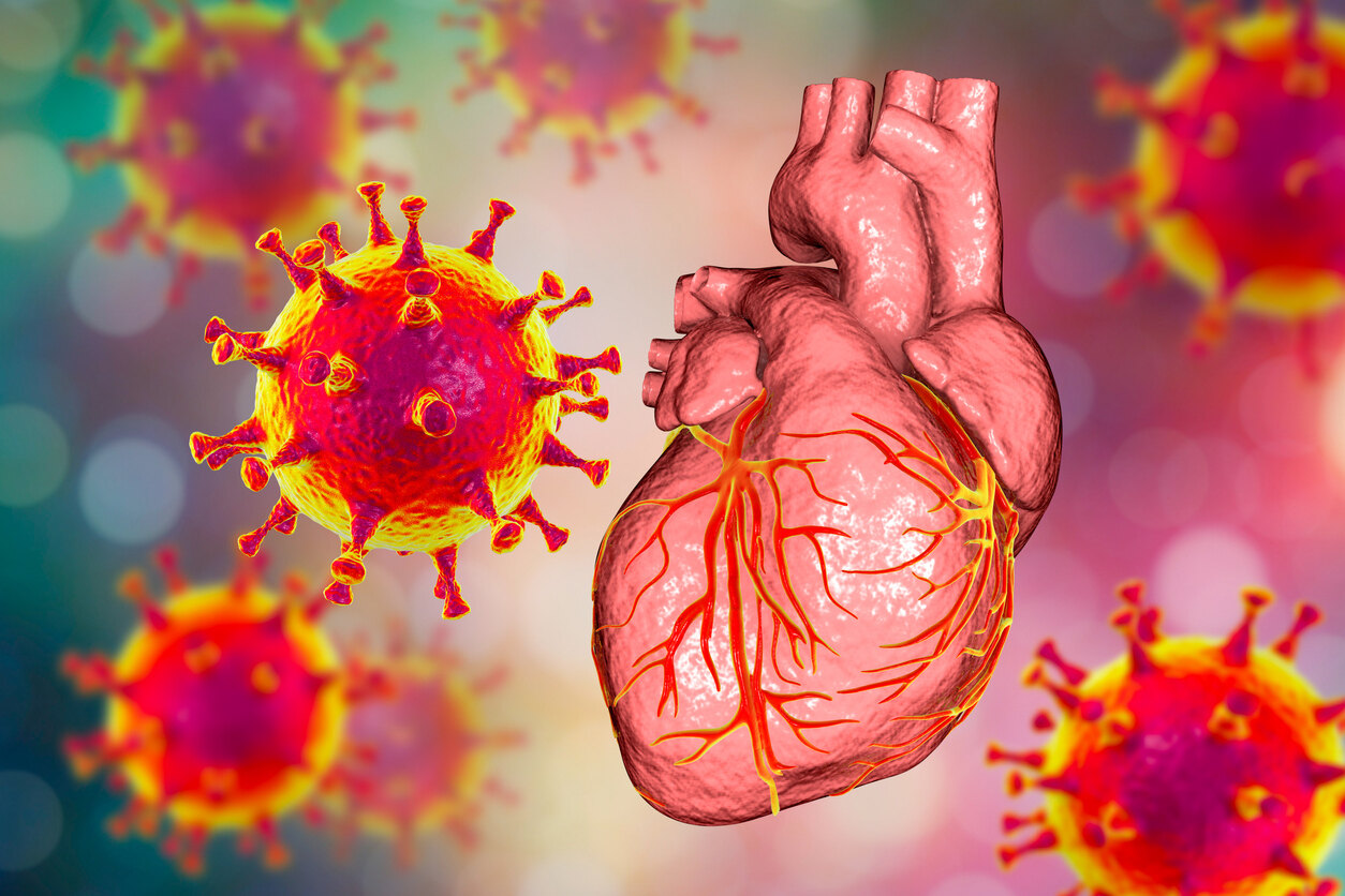 30-facts-about-post-infectious-myocarditis