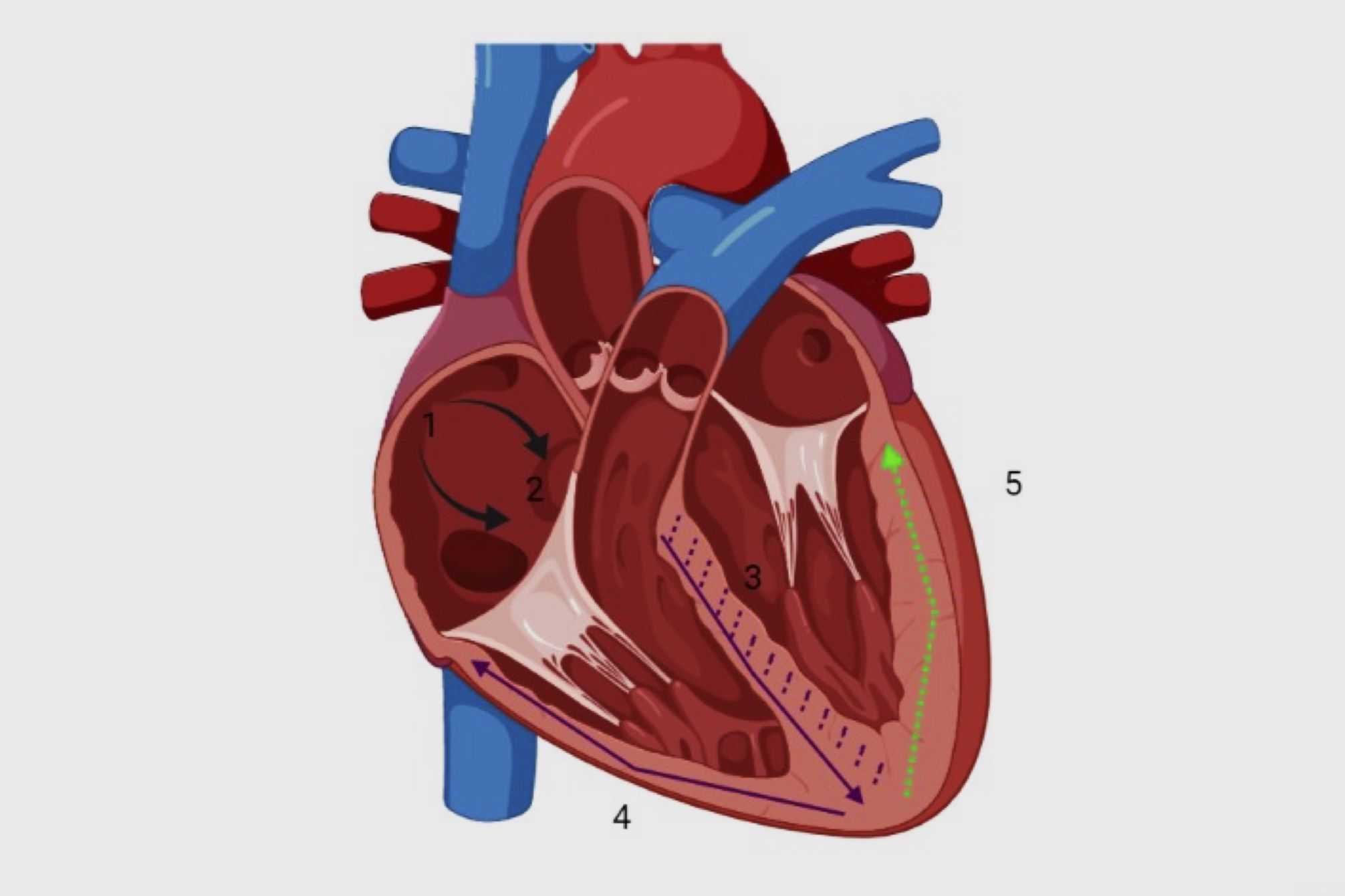 30-facts-about-sino-auricular-heart-block