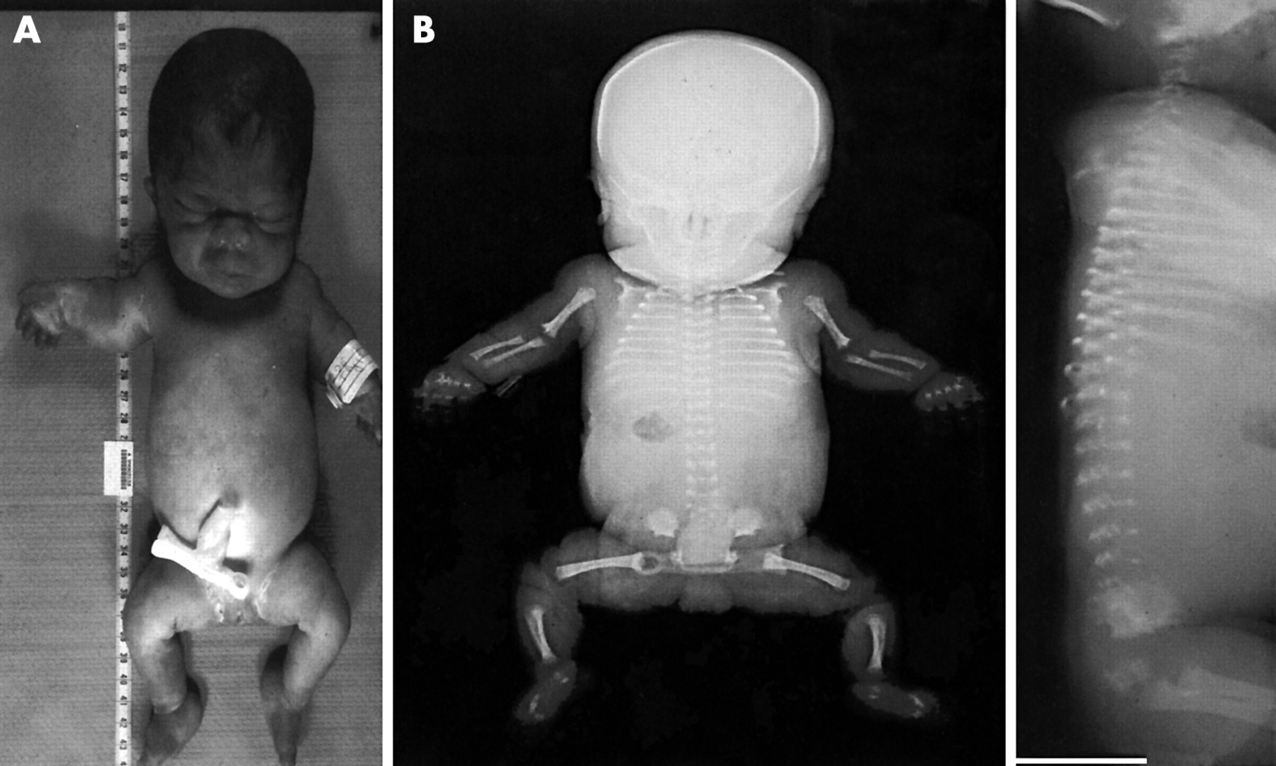 40-facts-about-opsismodysplasia