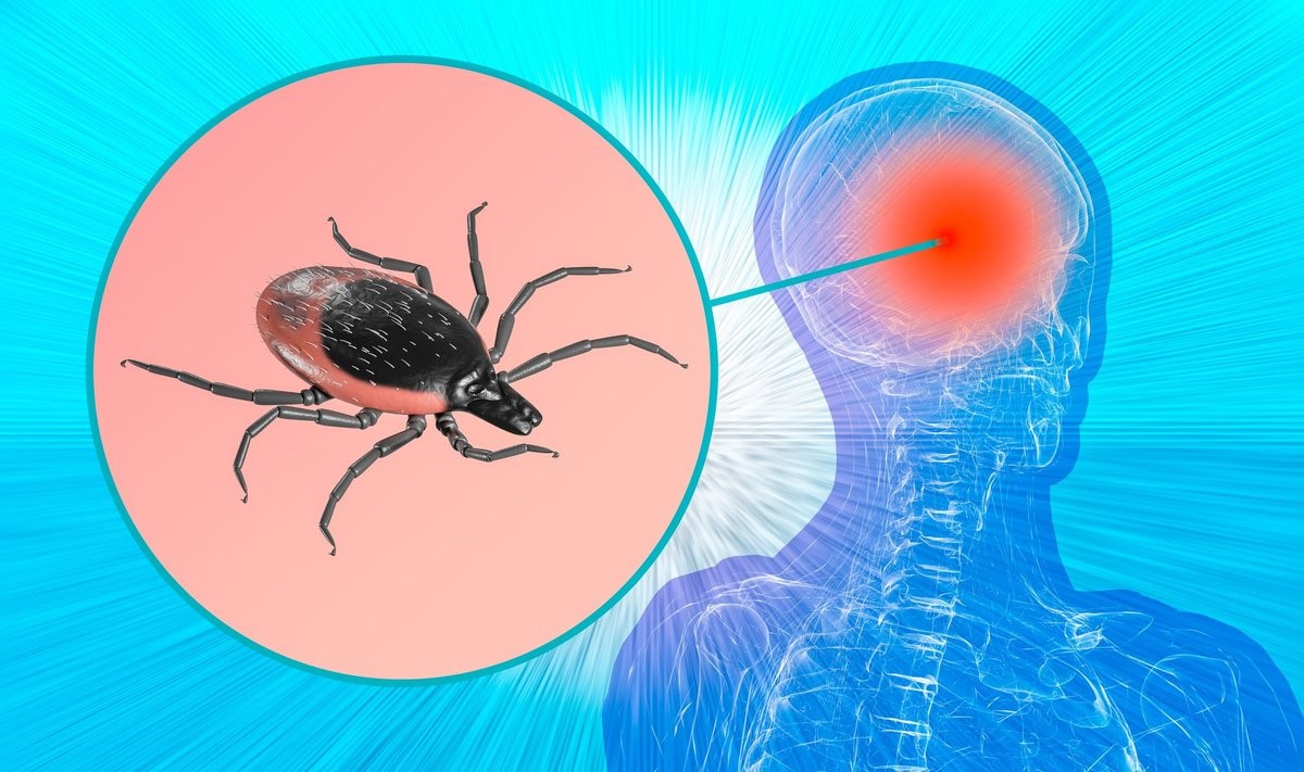 40-facts-about-tick-borne-encephalitis