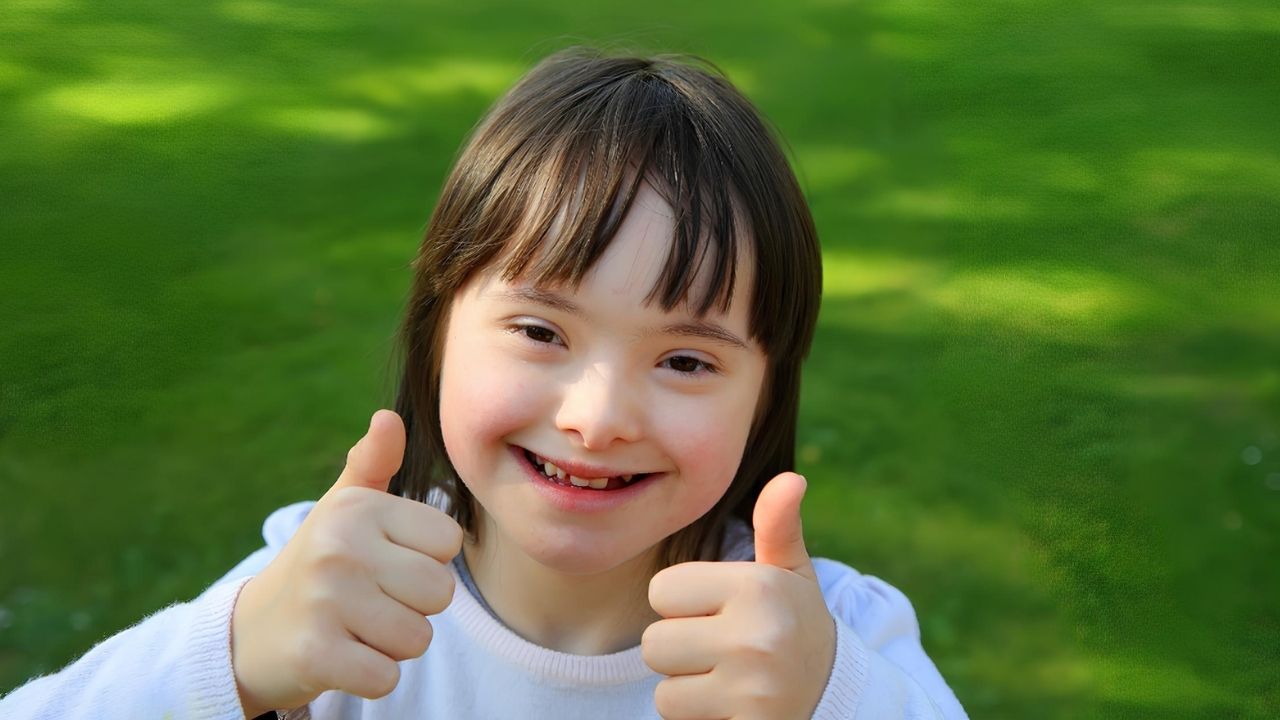 50 Facts About Angelman Syndrome - Facts.net