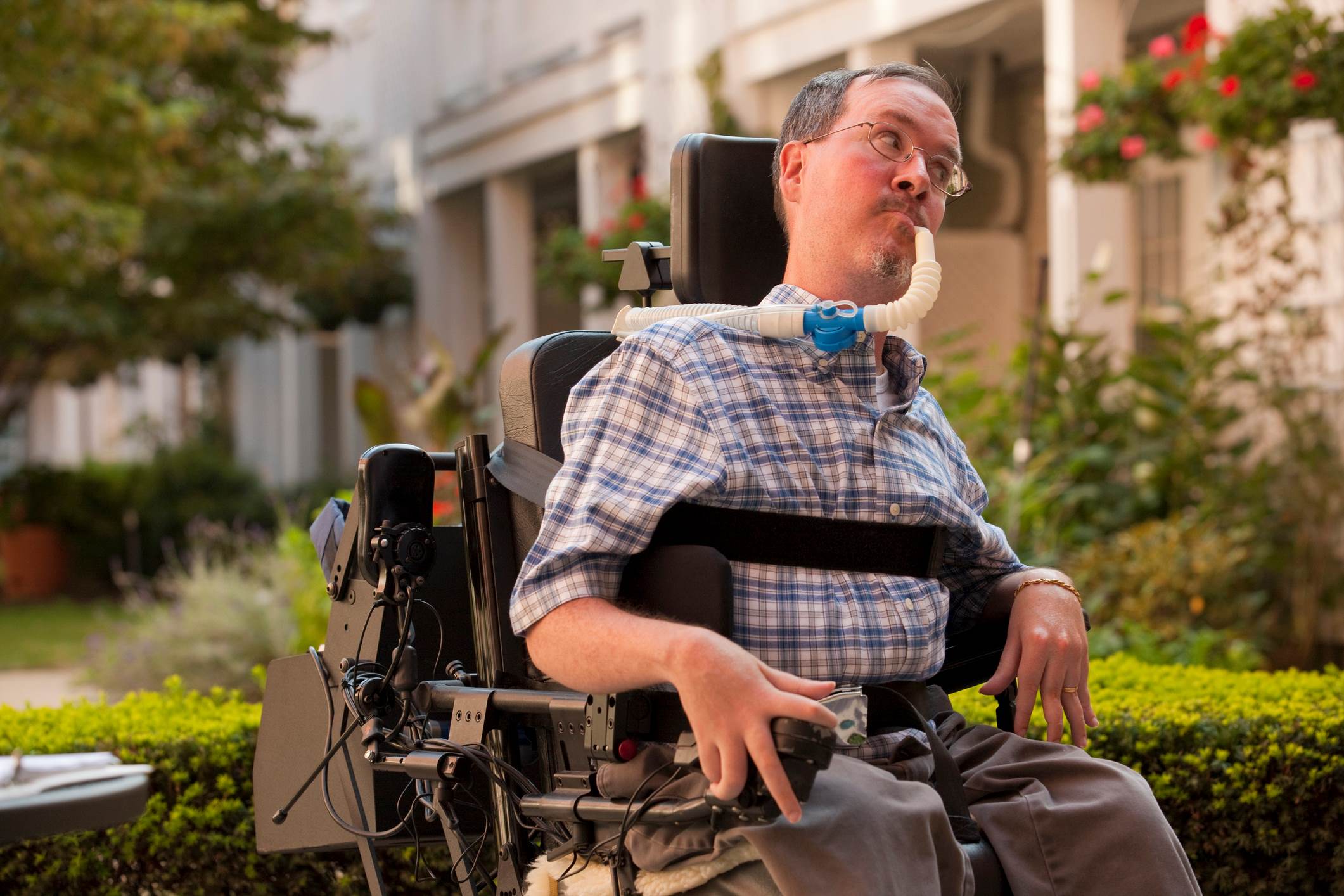 50-facts-about-becker-muscular-dystrophy