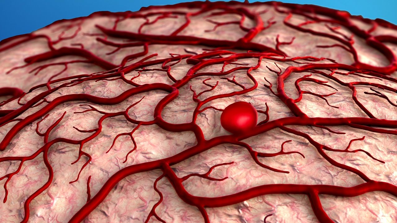 50-facts-about-brain-aneurysm