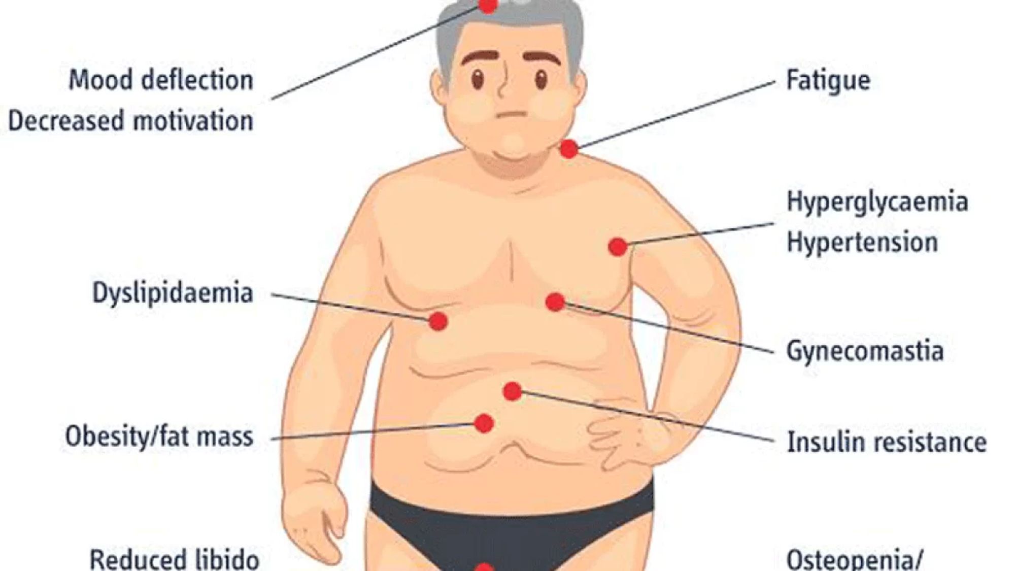 50-facts-about-hypogonadism