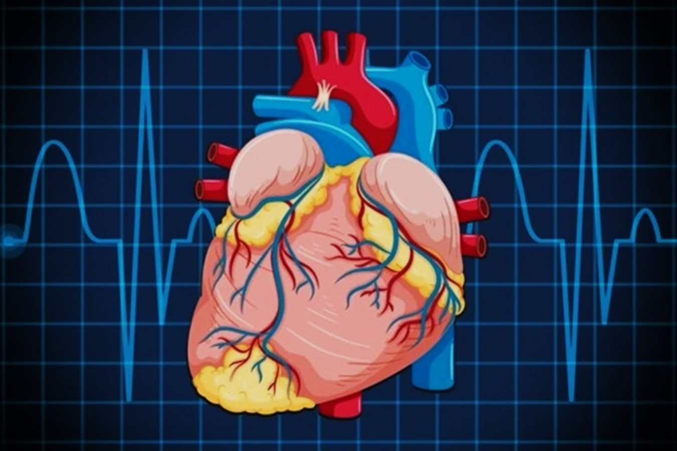 50-facts-about-idiopathic-dilation-cardiomyopathy