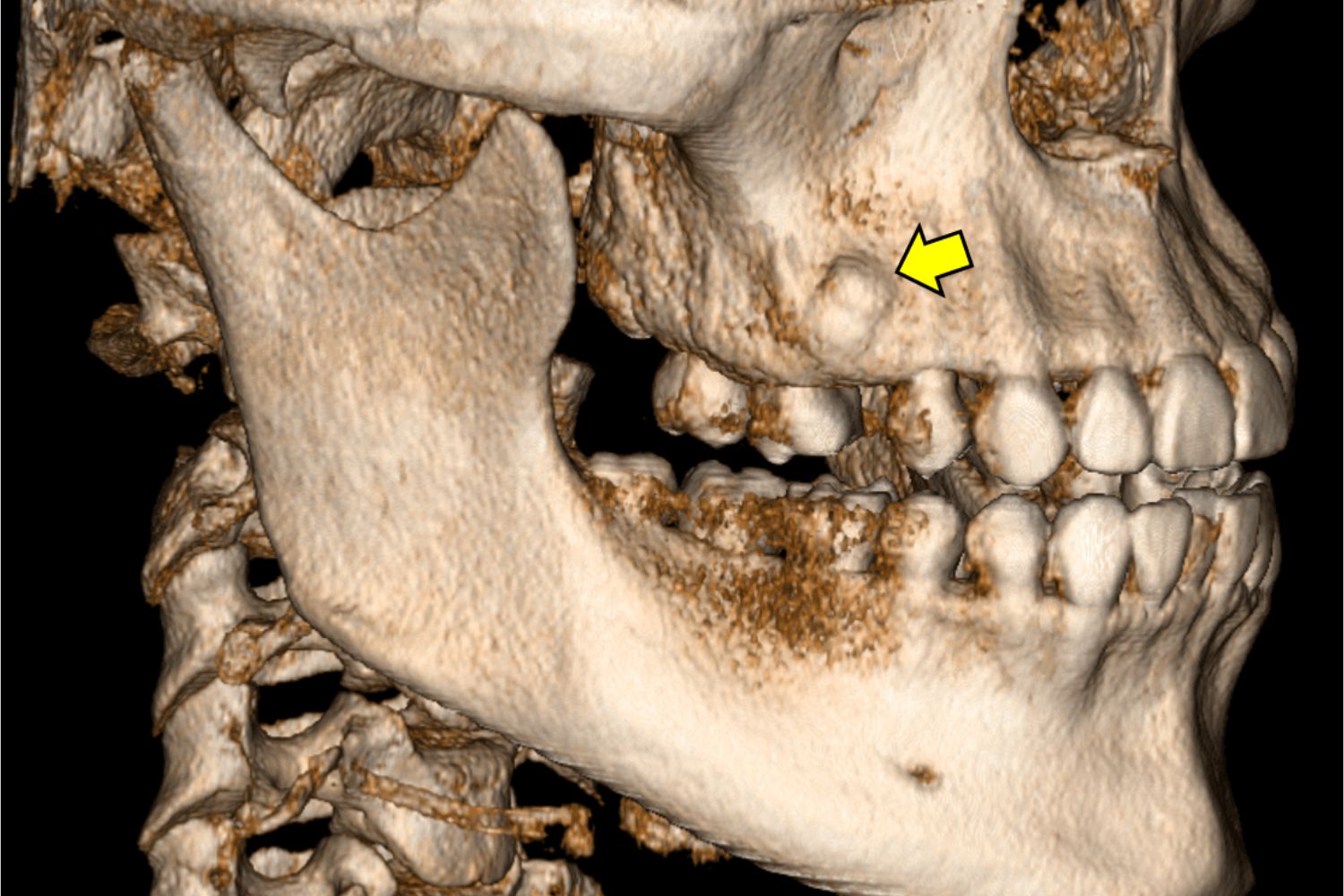 50-facts-about-odontoma