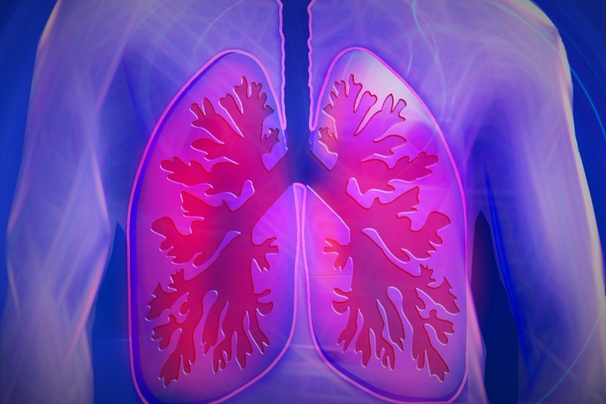 50-facts-about-pneumonoultramicroscopicsilicovolcanoconiosis